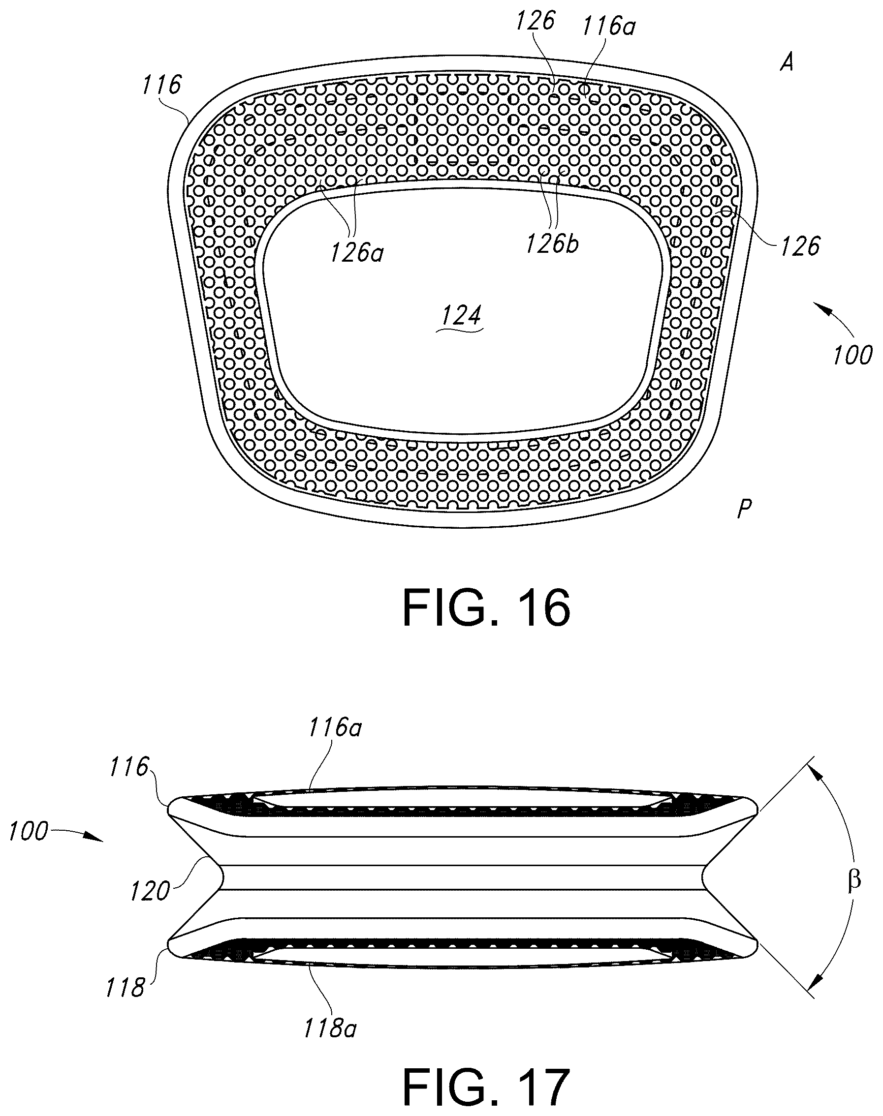 Patent US12303402 Figure 10 – Spinal interbody fusion device