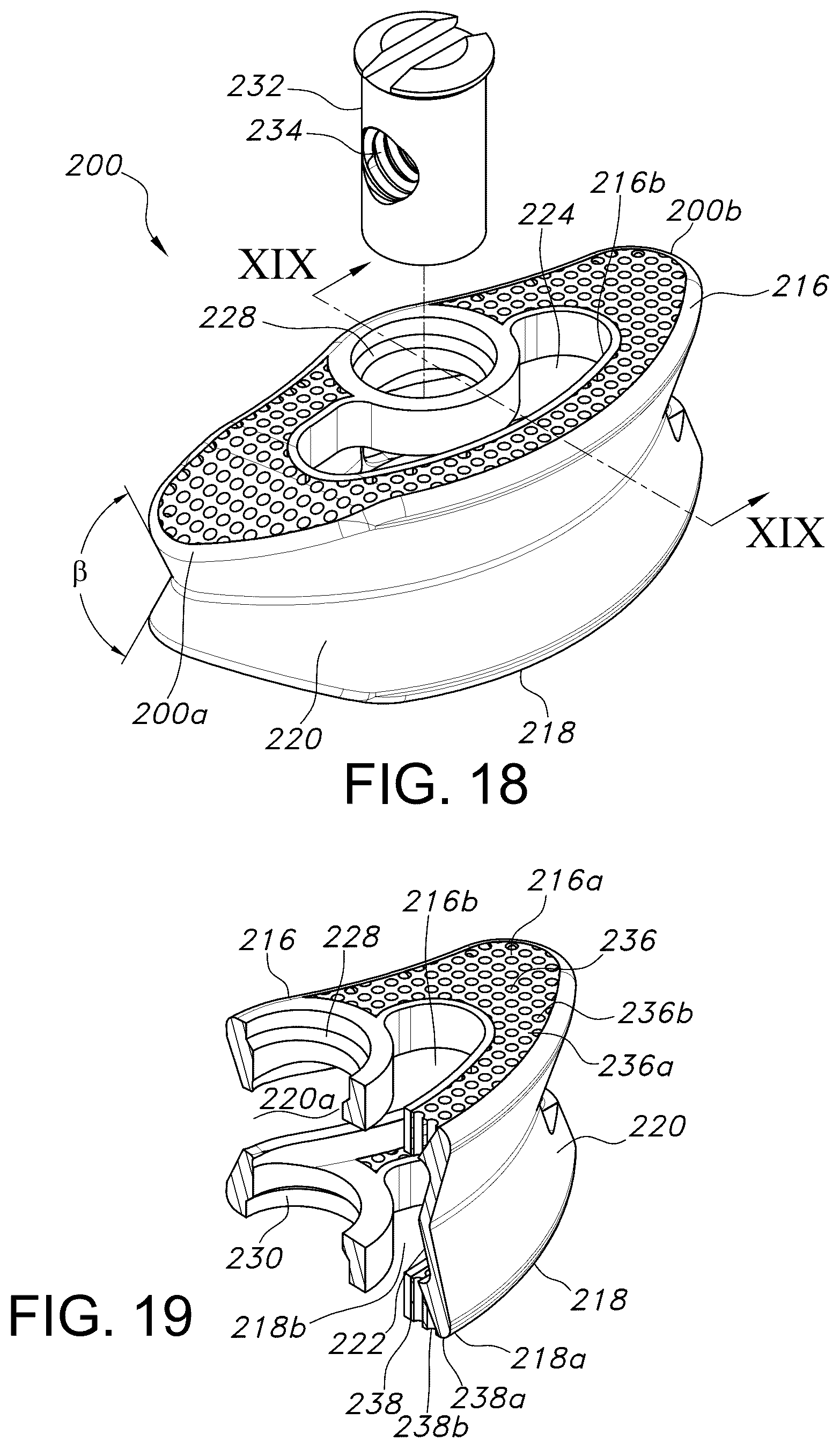 Patent US12303402 Figure 11 – Spinal interbody fusion device