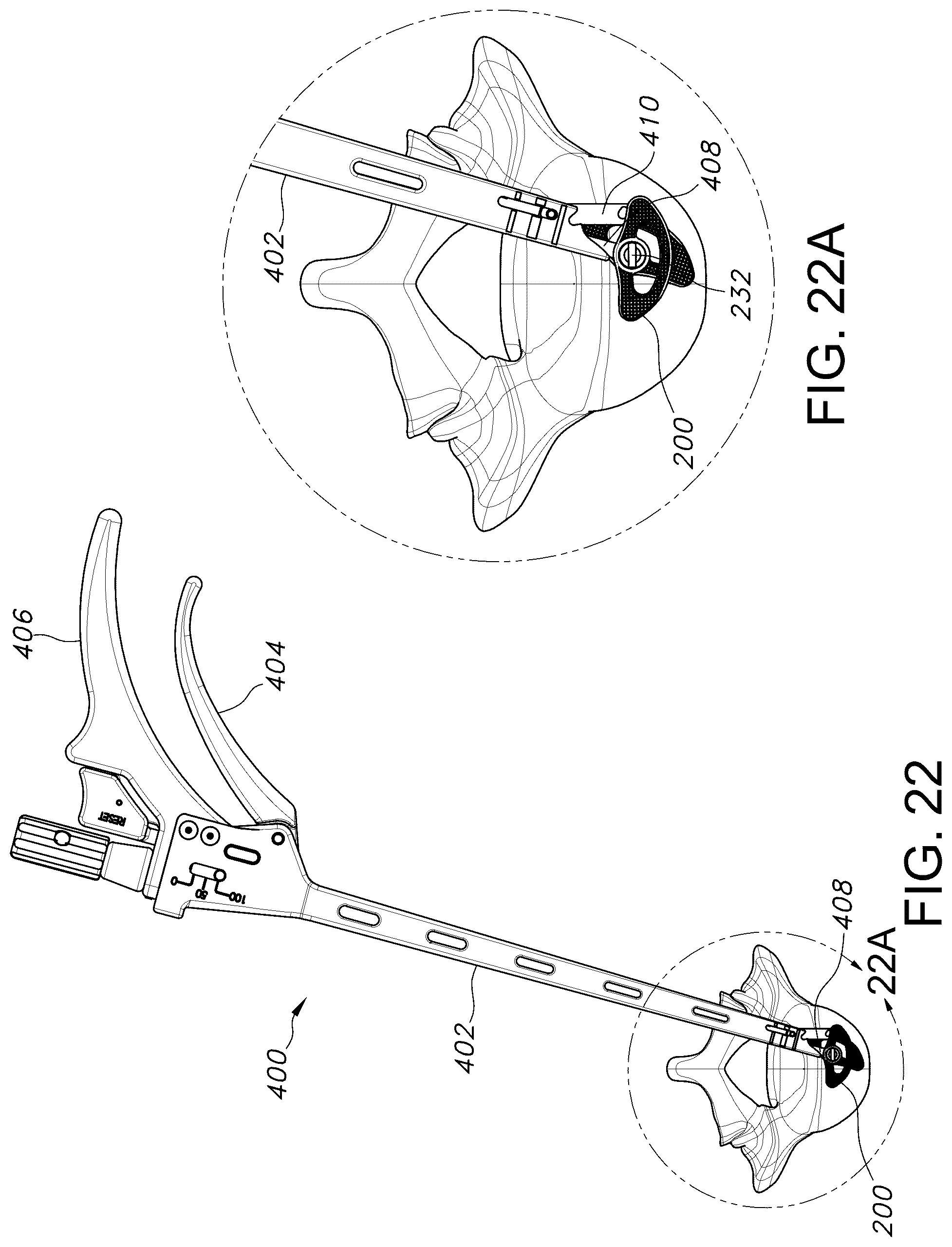 Patent US12303402 Figure 13 – Spinal interbody fusion device