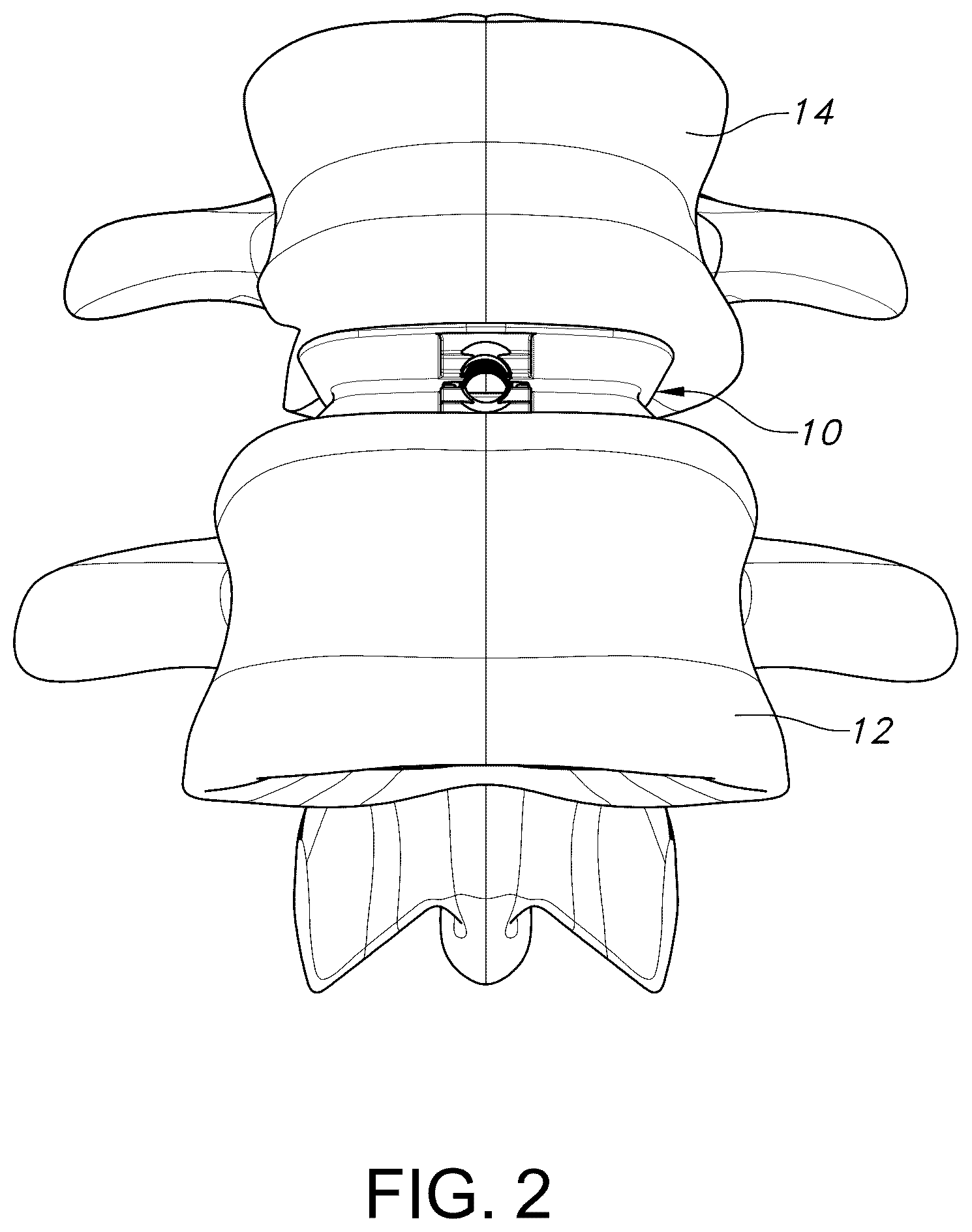 Patent US12303403 Figure 2 – Spinal interbody fusion device