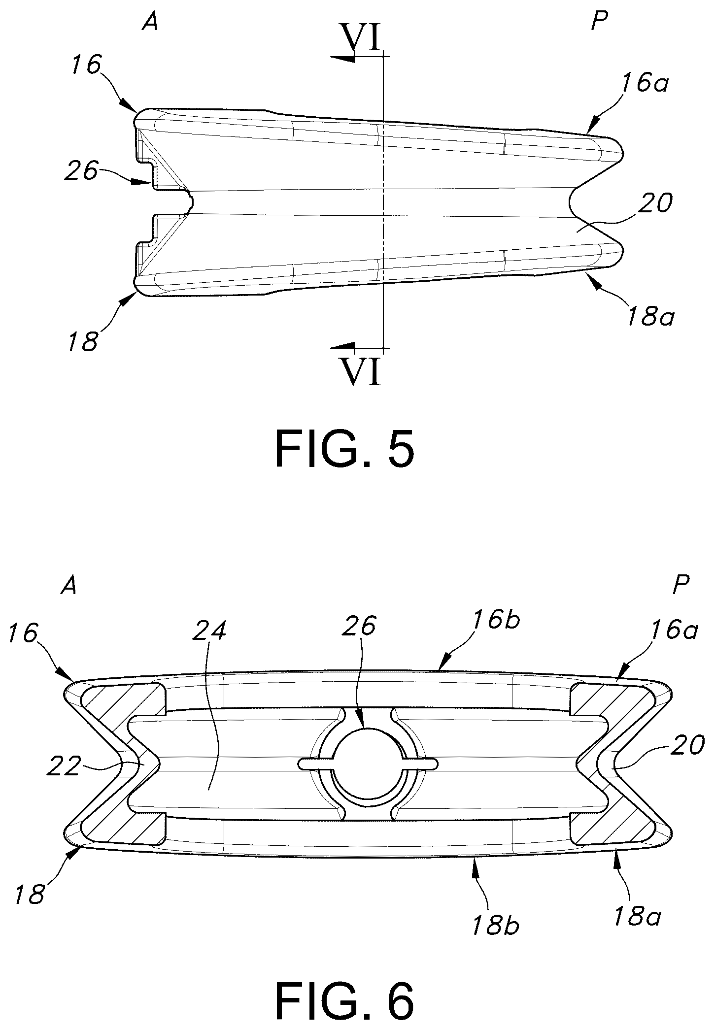 Patent US12303403 Figure 4 – Spinal interbody fusion device
