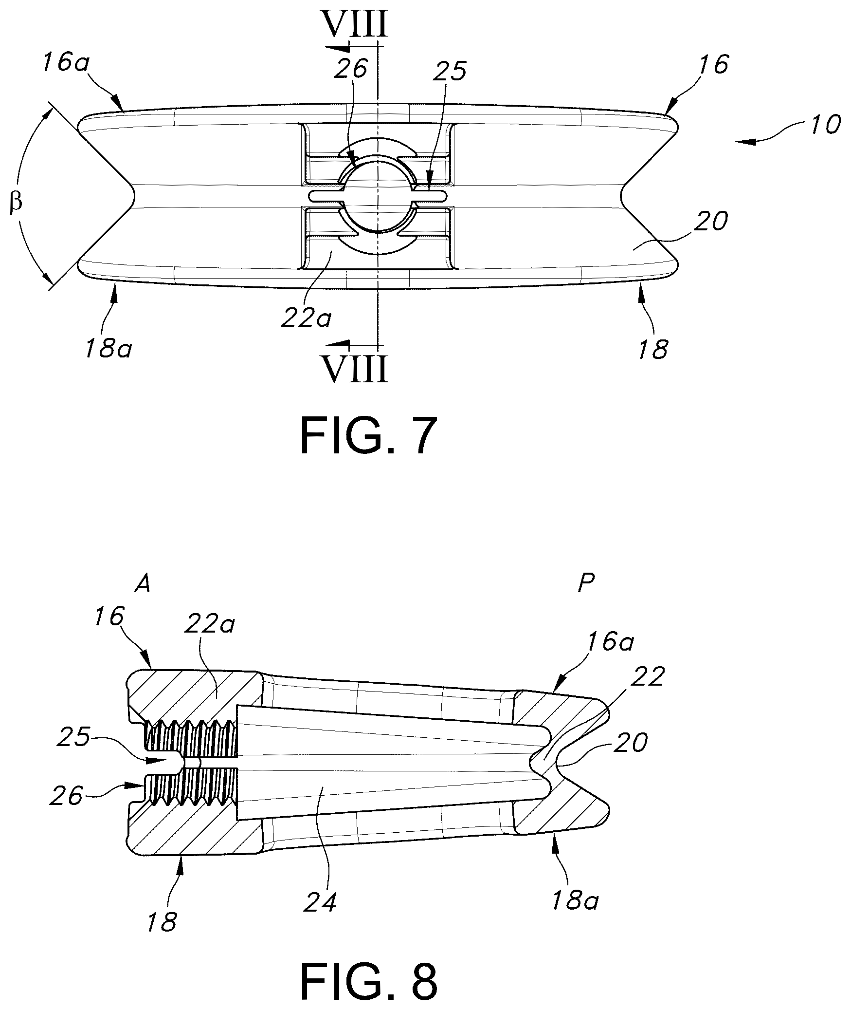 Patent US12303403 Figure 5 – Spinal interbody fusion device