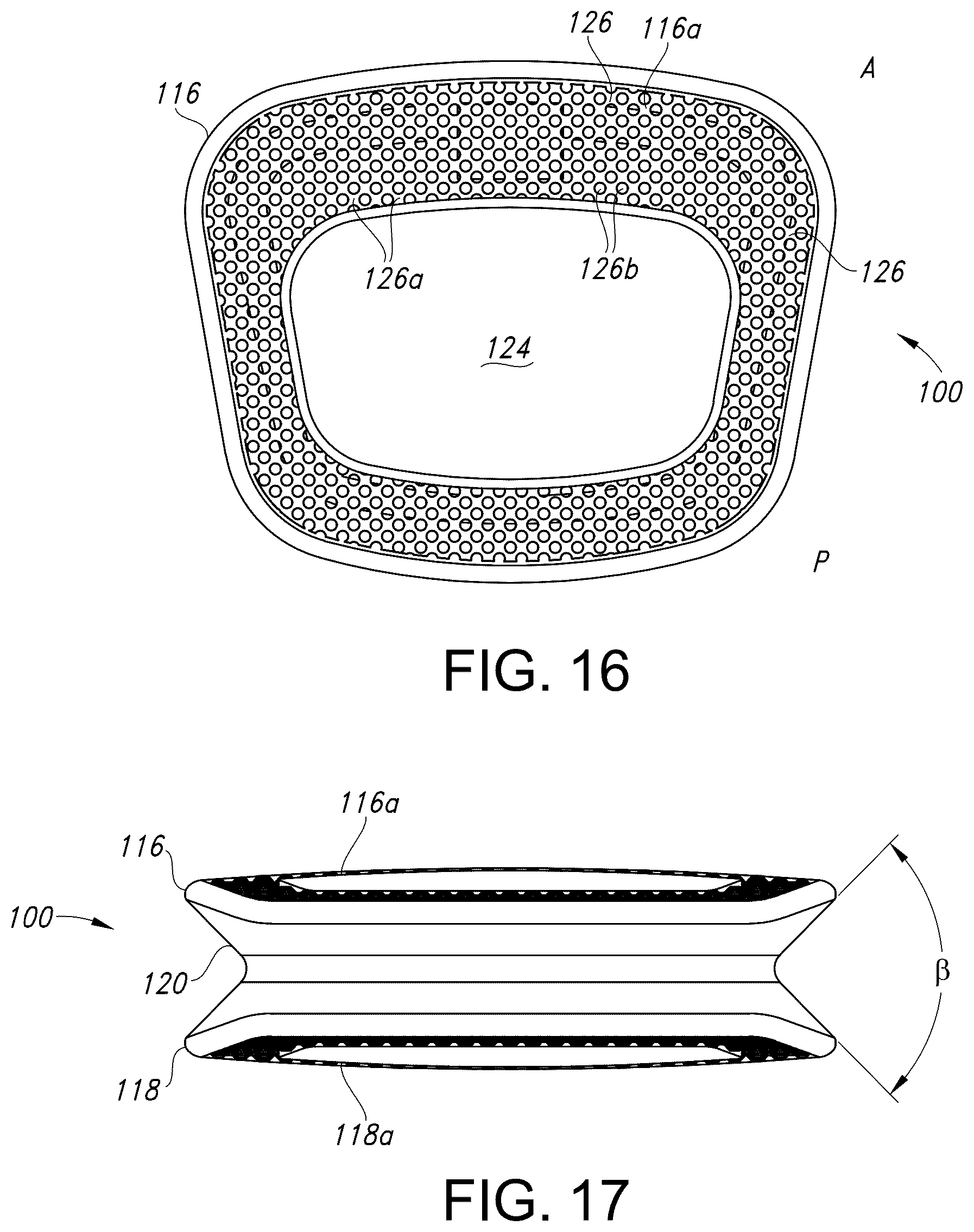 Patent US12303403 Figure 10 – Spinal interbody fusion device