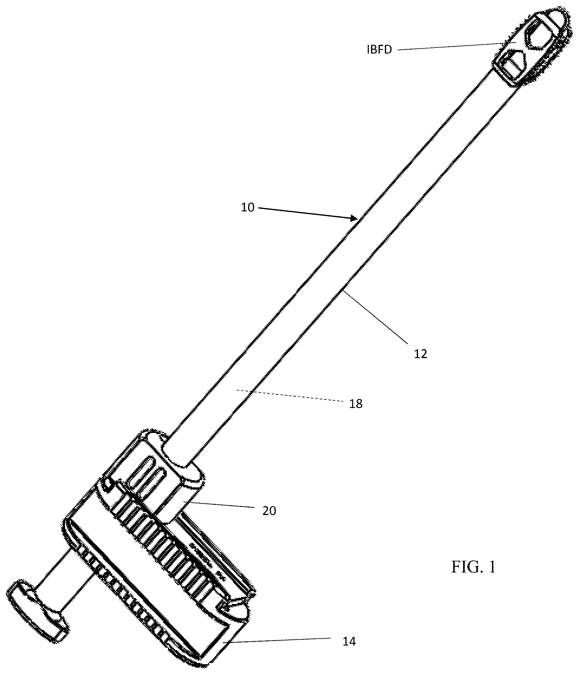 Patent US12303404 Figure 1 – Graft delivery system