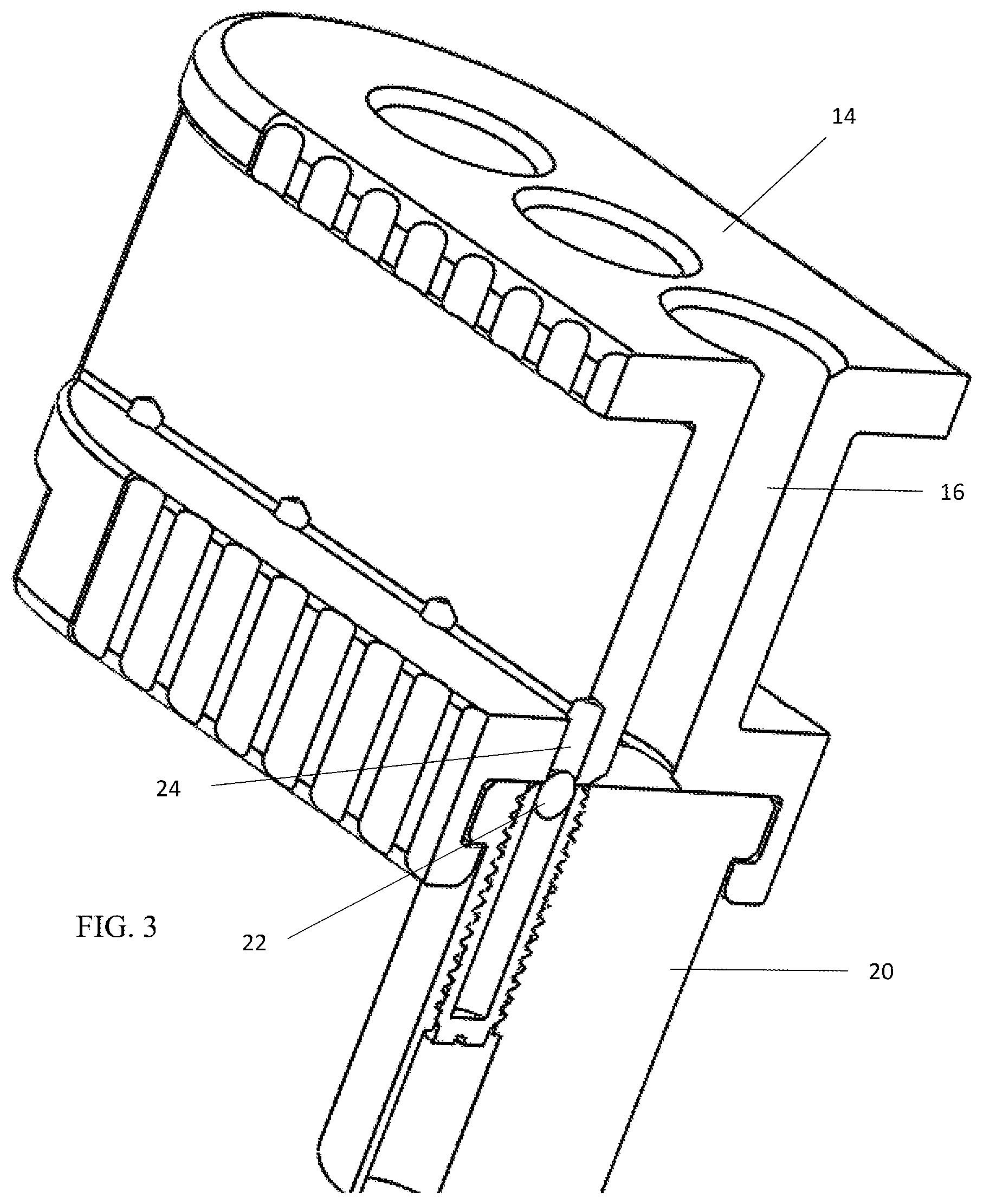 Patent US12303404 Figure 3 – Graft delivery system