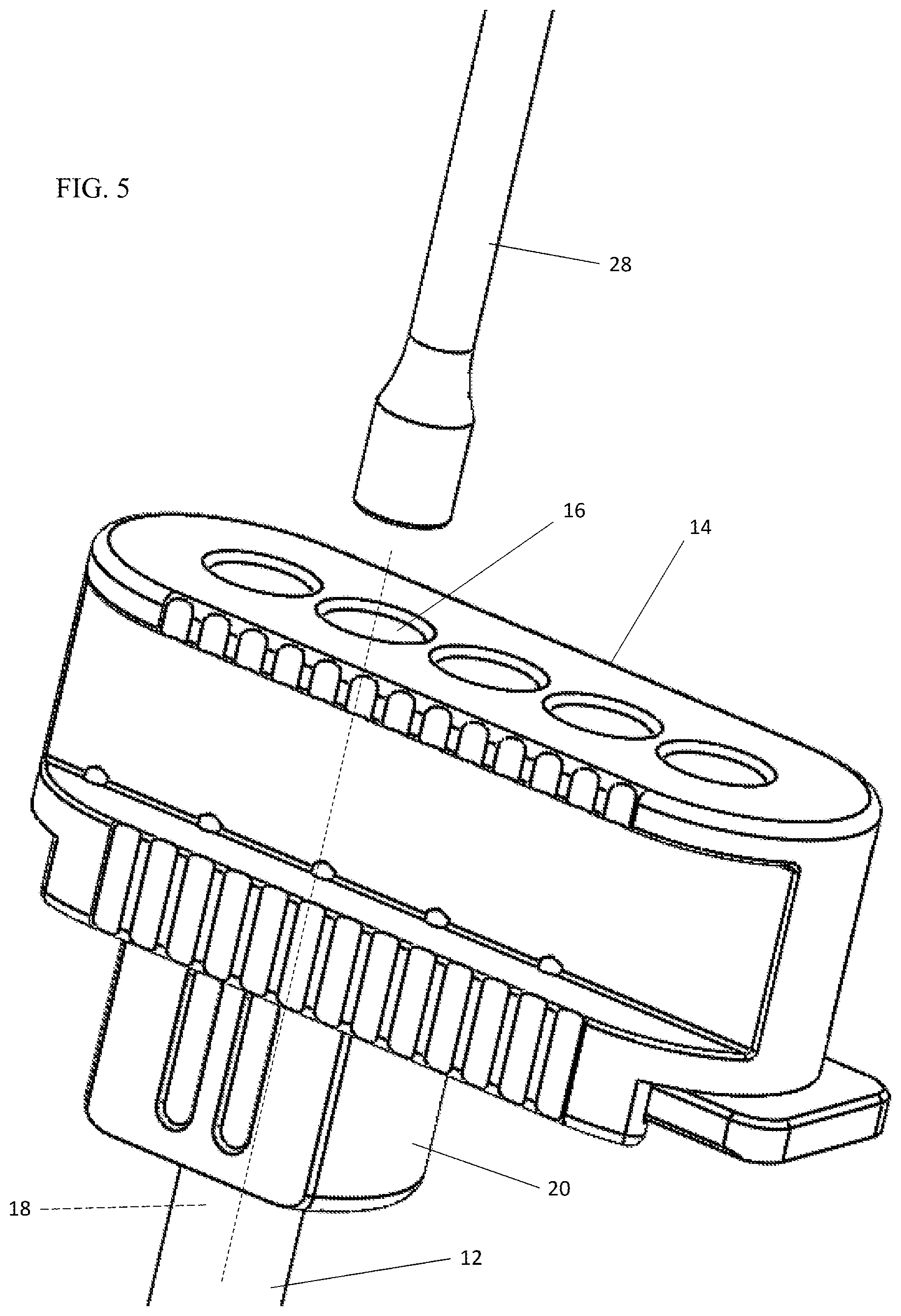 Patent US12303404 Figure 5 – Graft delivery system
