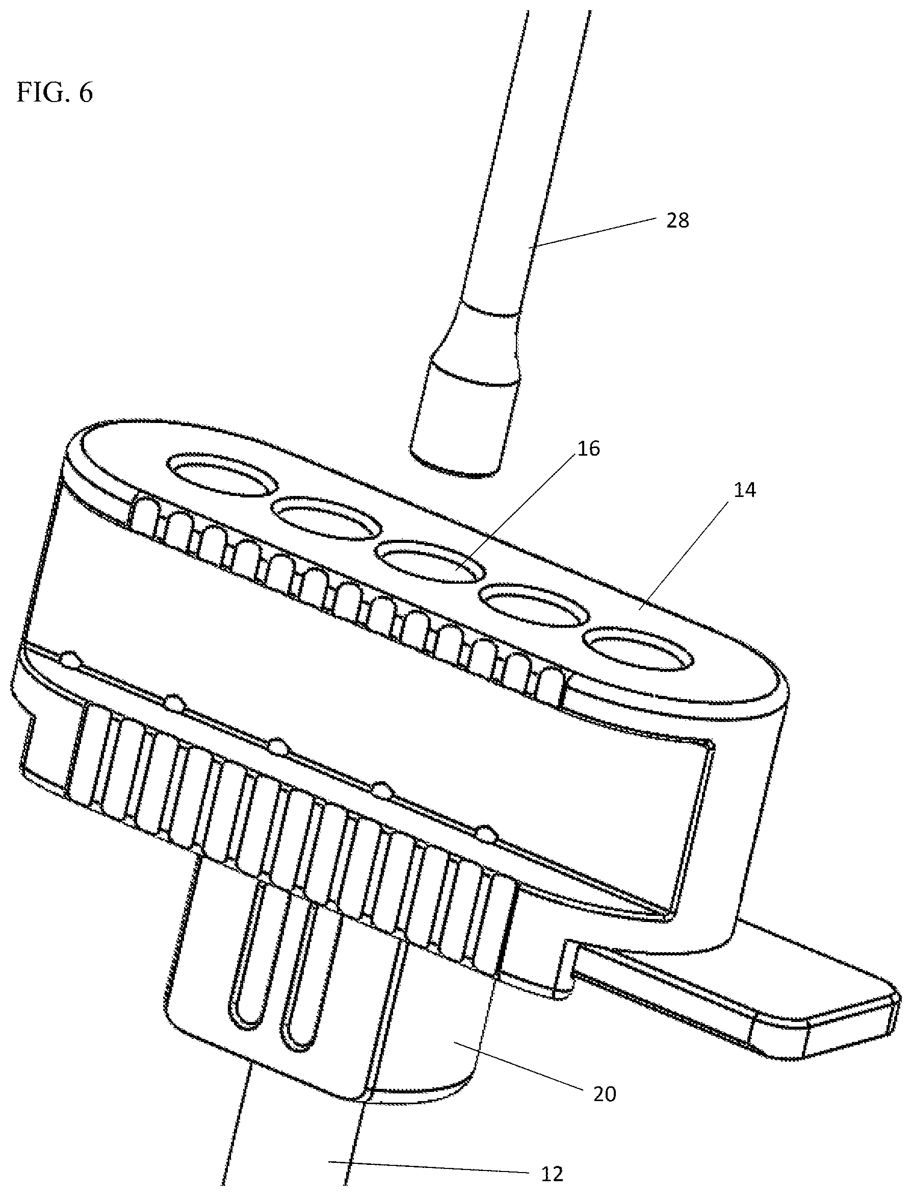 Patent US12303404 Figure 6 – Graft delivery system