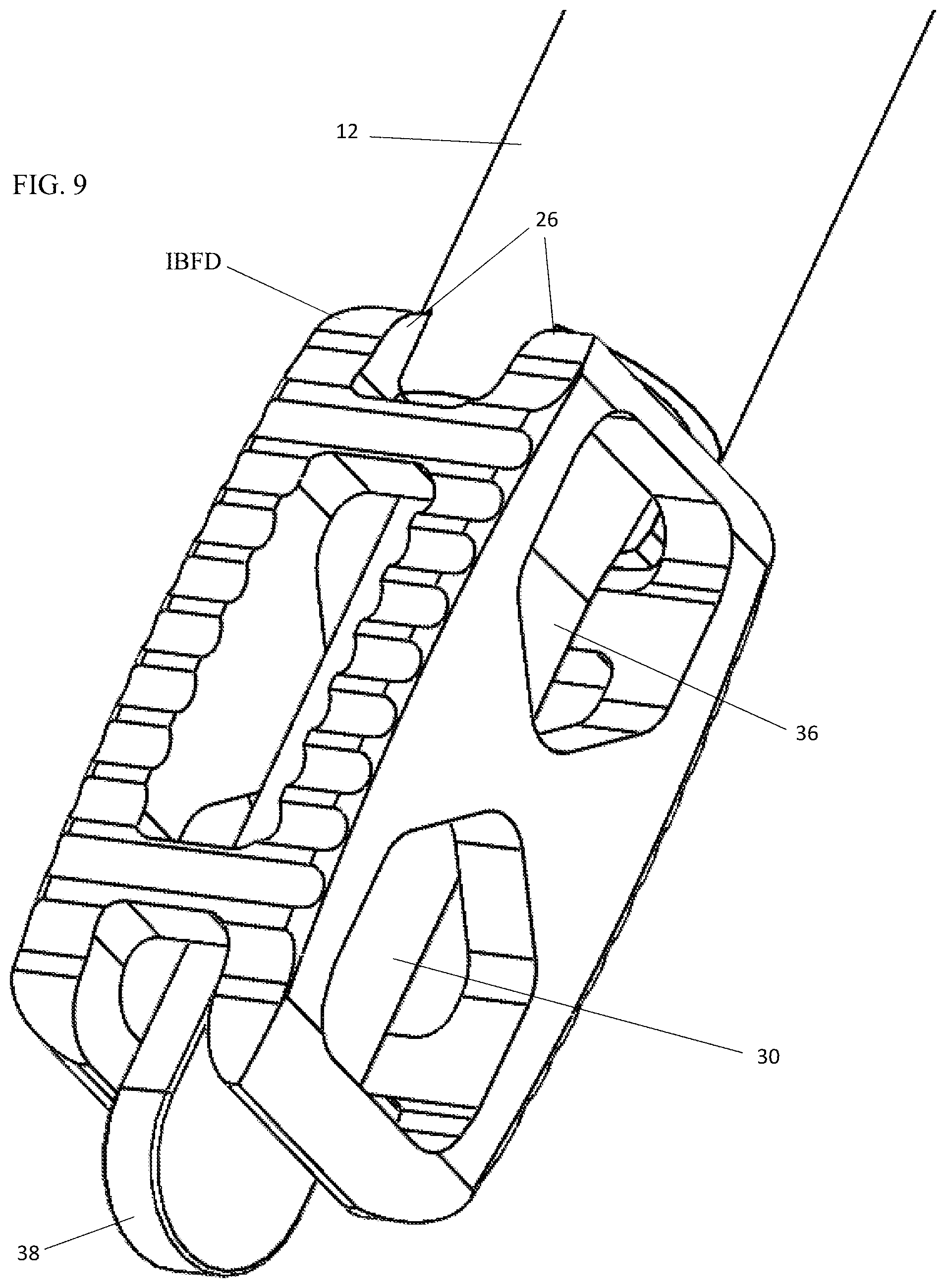 Patent US12303404 Figure 9 – Graft delivery system