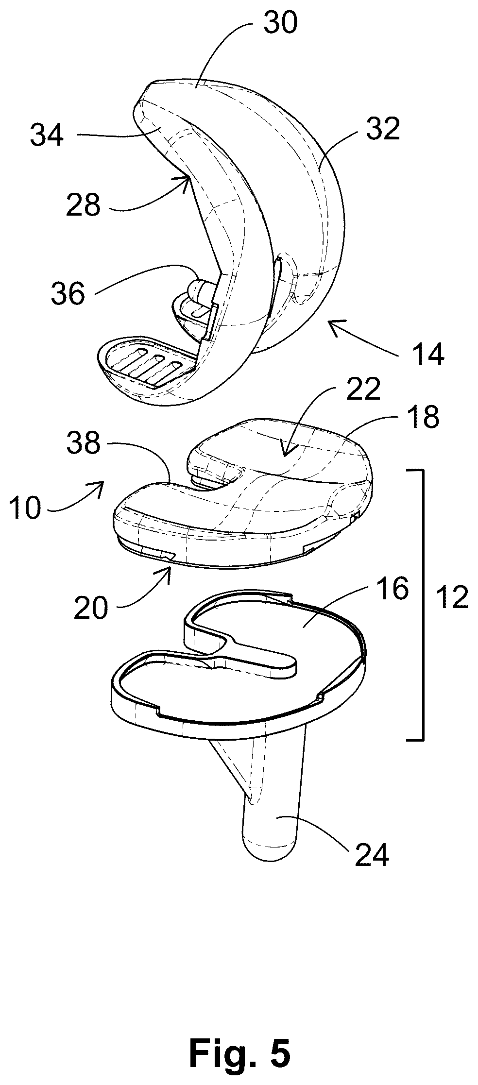 Patent US12303405 Figure 3 – Knee arthroplasty method