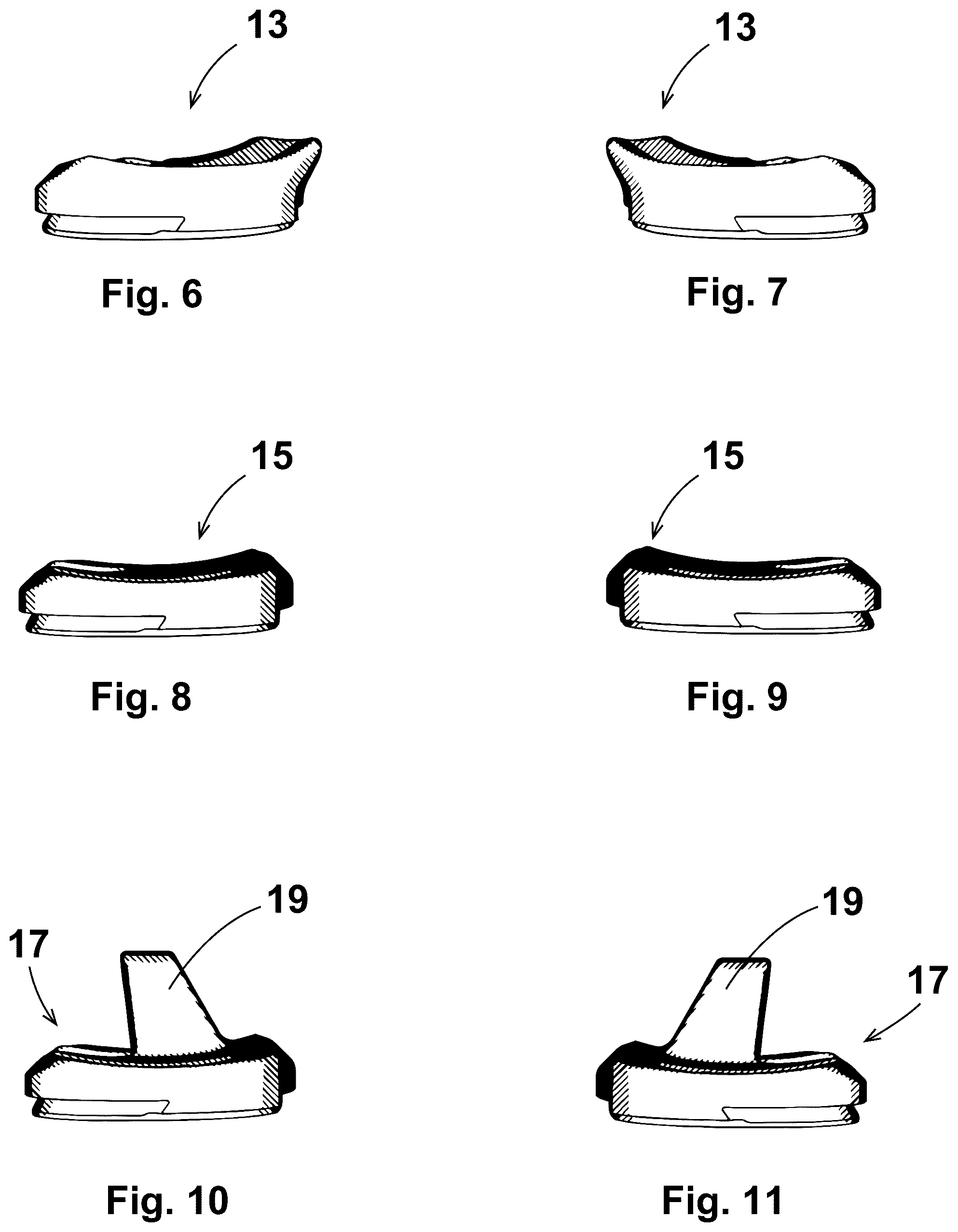 Patent US12303405 Figure 4 – Knee arthroplasty method