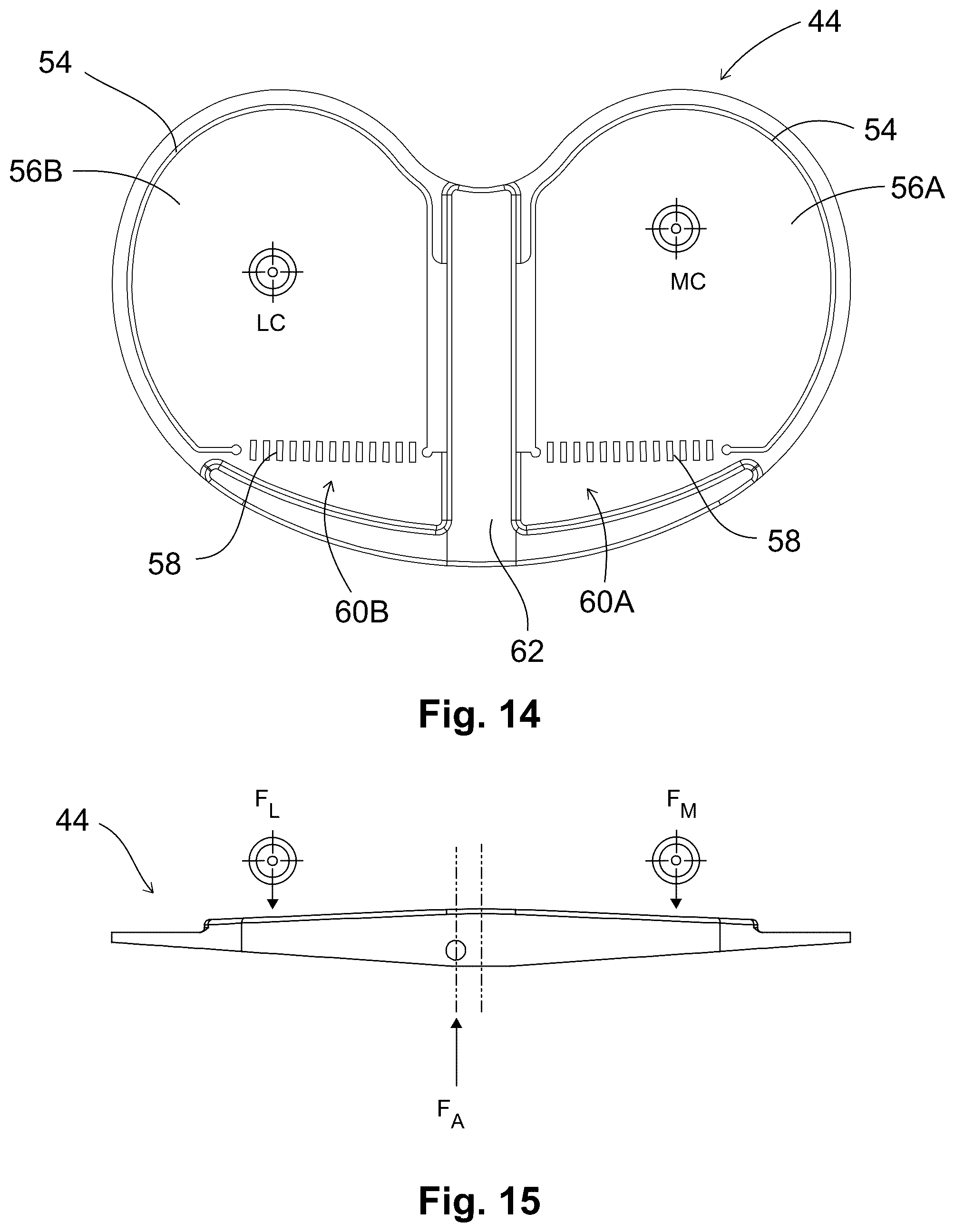 Patent US12303405 Figure 6 – Knee arthroplasty method