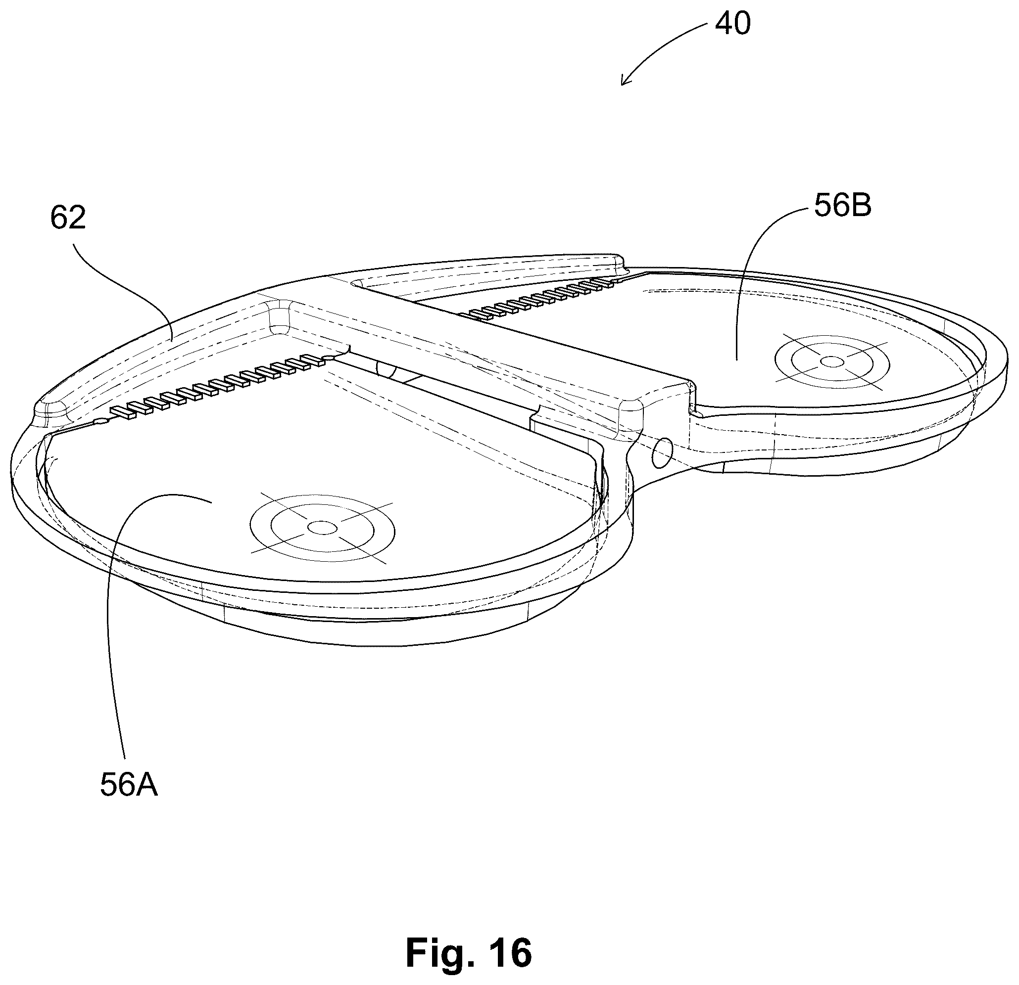 Patent US12303405 Figure 7 – Knee arthroplasty method