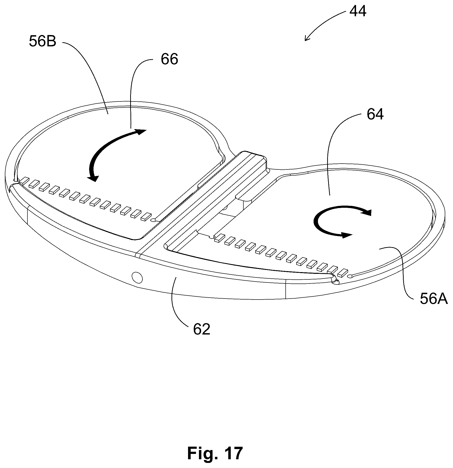 Patent US12303405 Figure 8 – Knee arthroplasty method