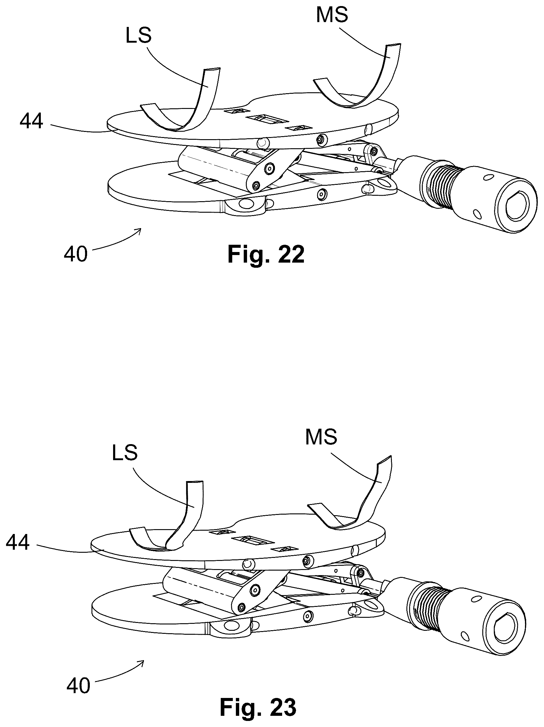 Patent US12303405 Figure 13 – Knee arthroplasty method