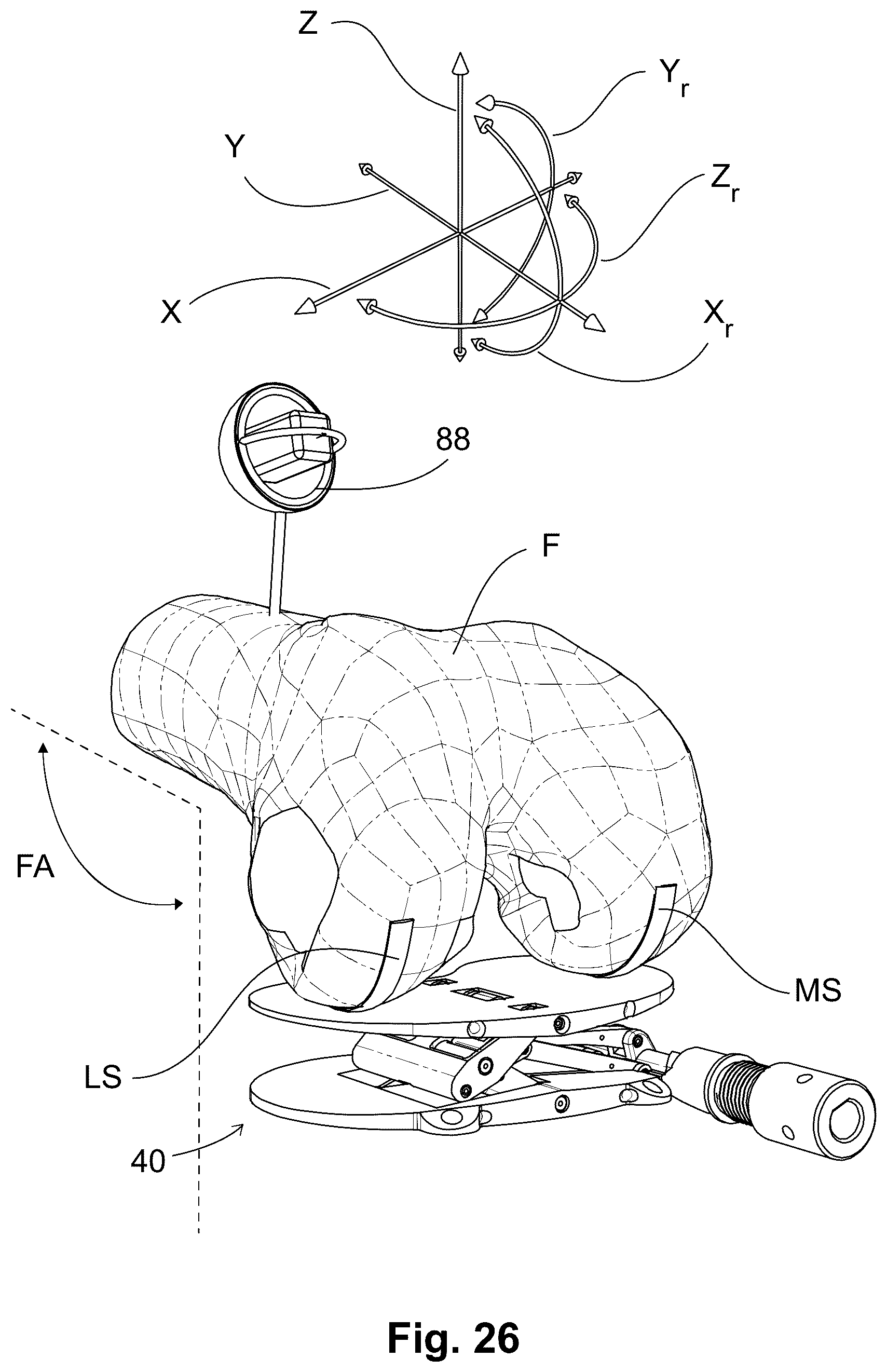 Patent US12303405 Figure 15 – Knee arthroplasty method
