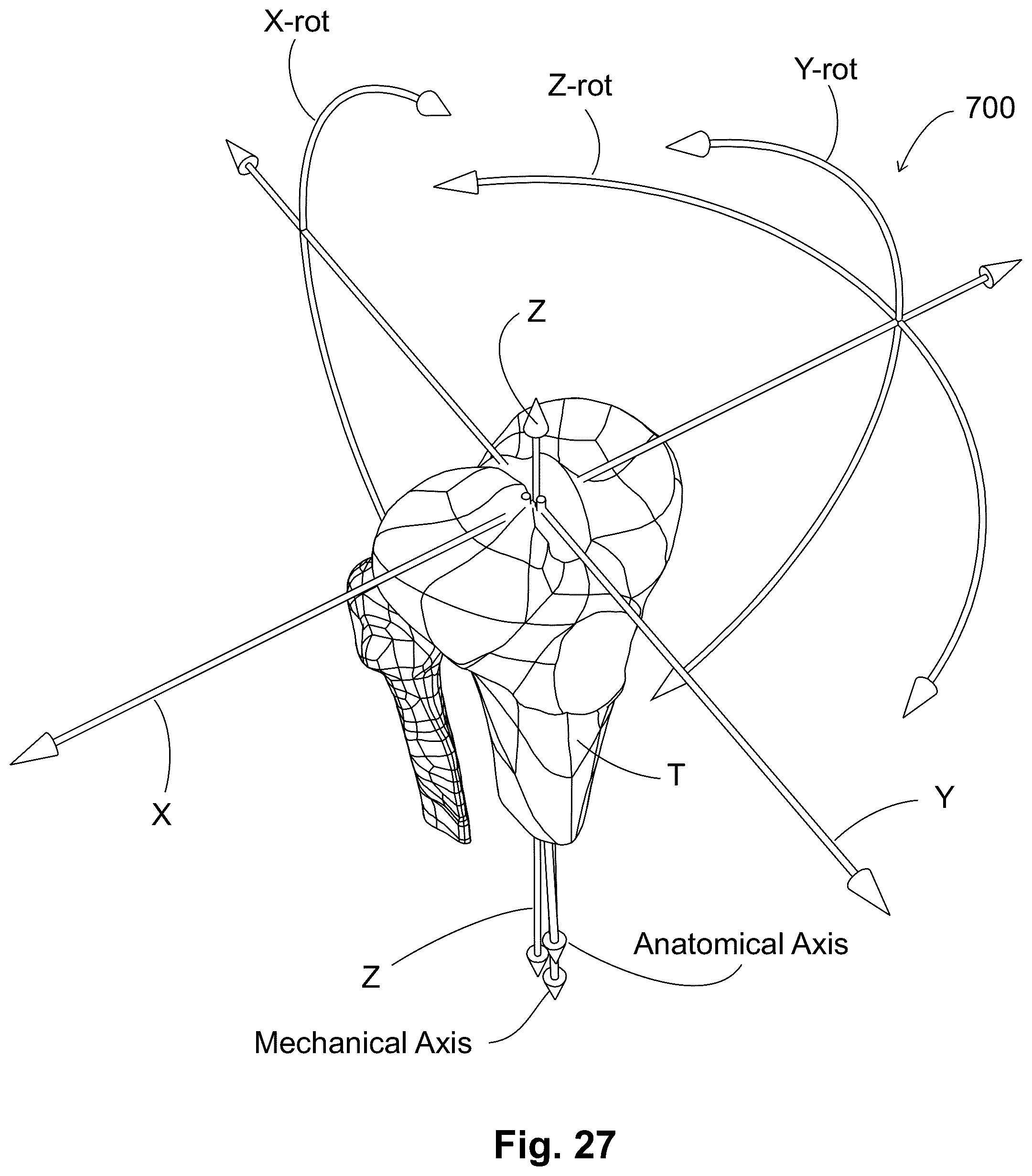 Patent US12303405 Figure 16 – Knee arthroplasty method
