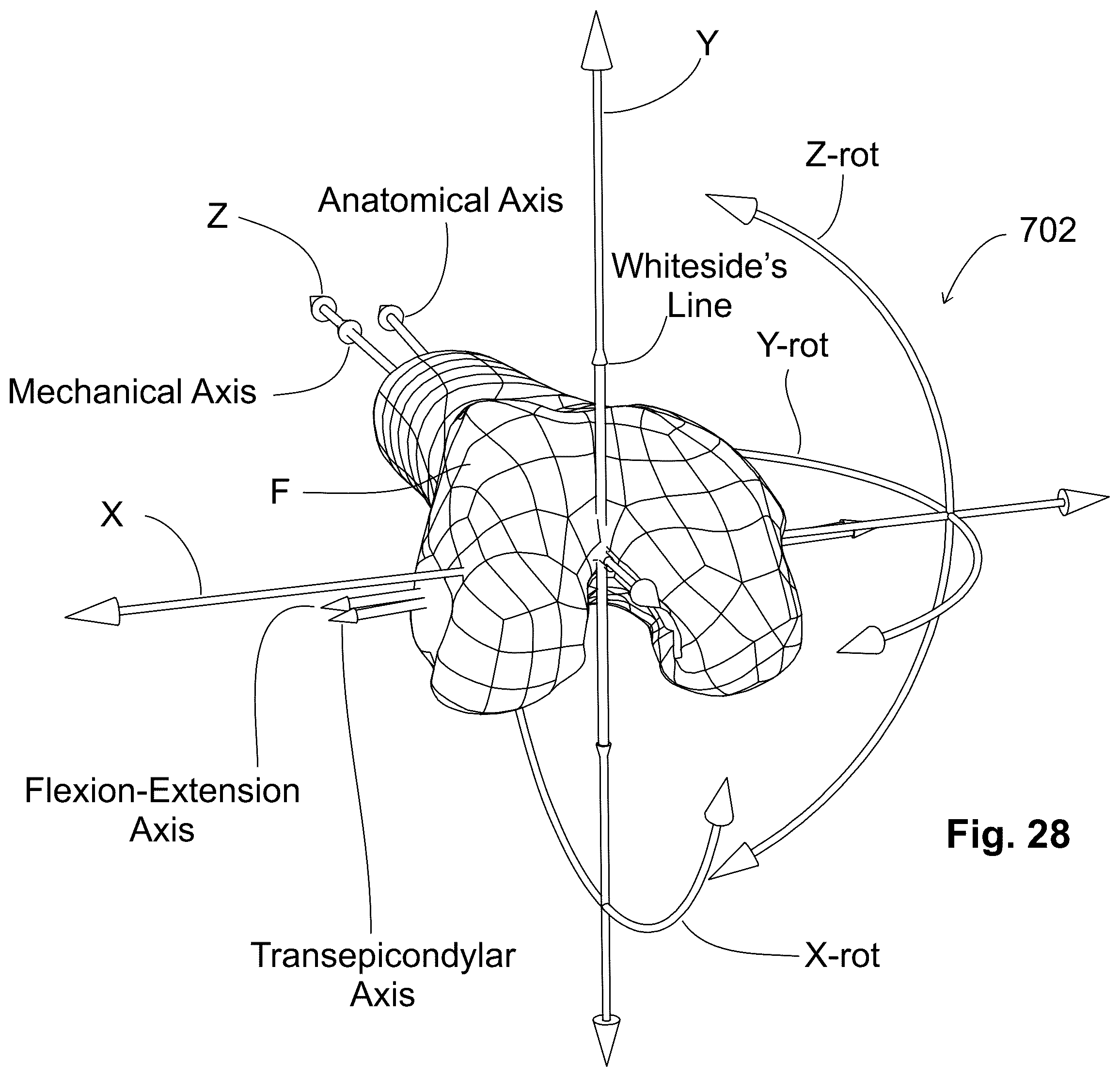 Patent US12303405 Figure 17 – Knee arthroplasty method