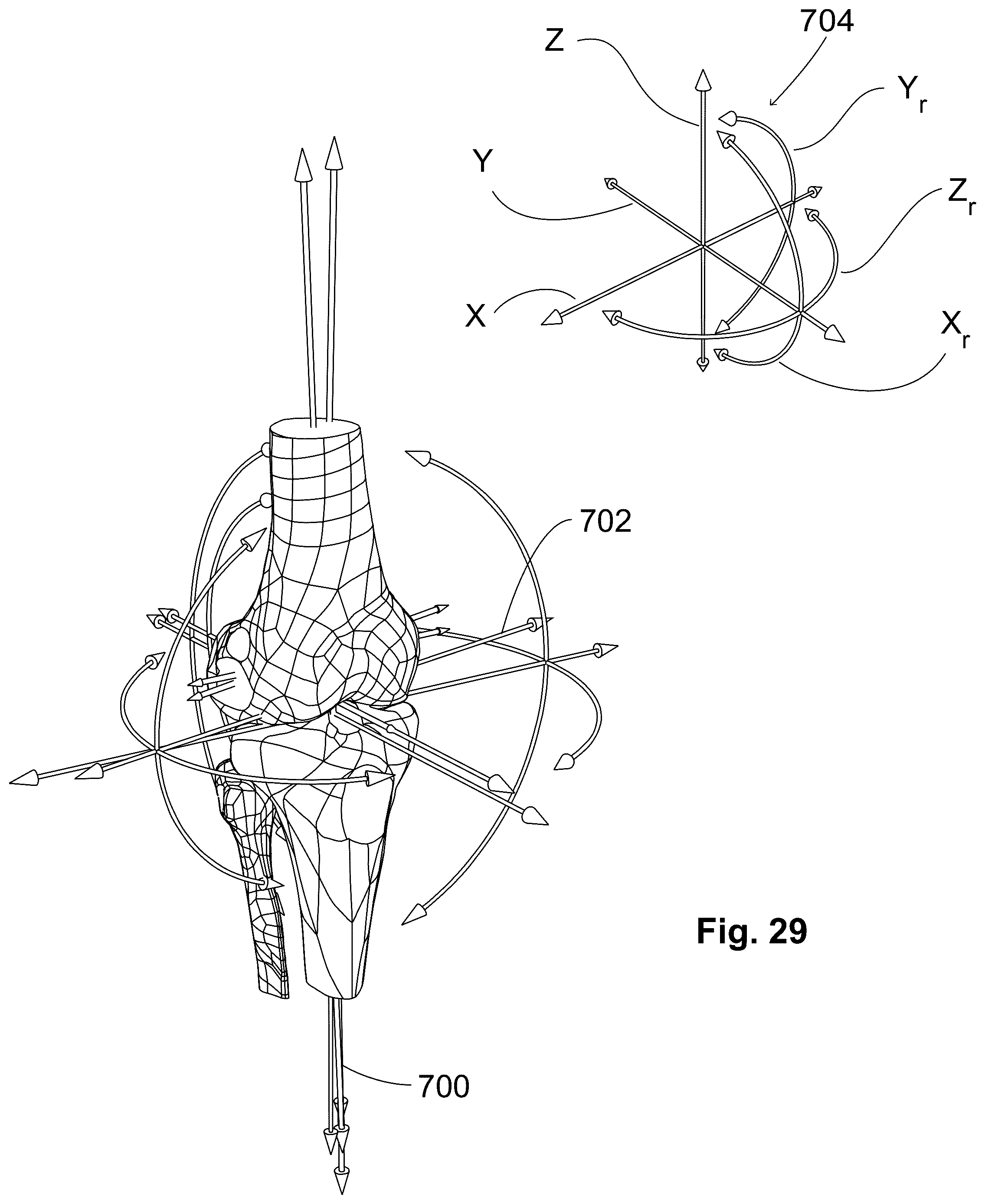 Patent US12303405 Figure 18 – Knee arthroplasty method