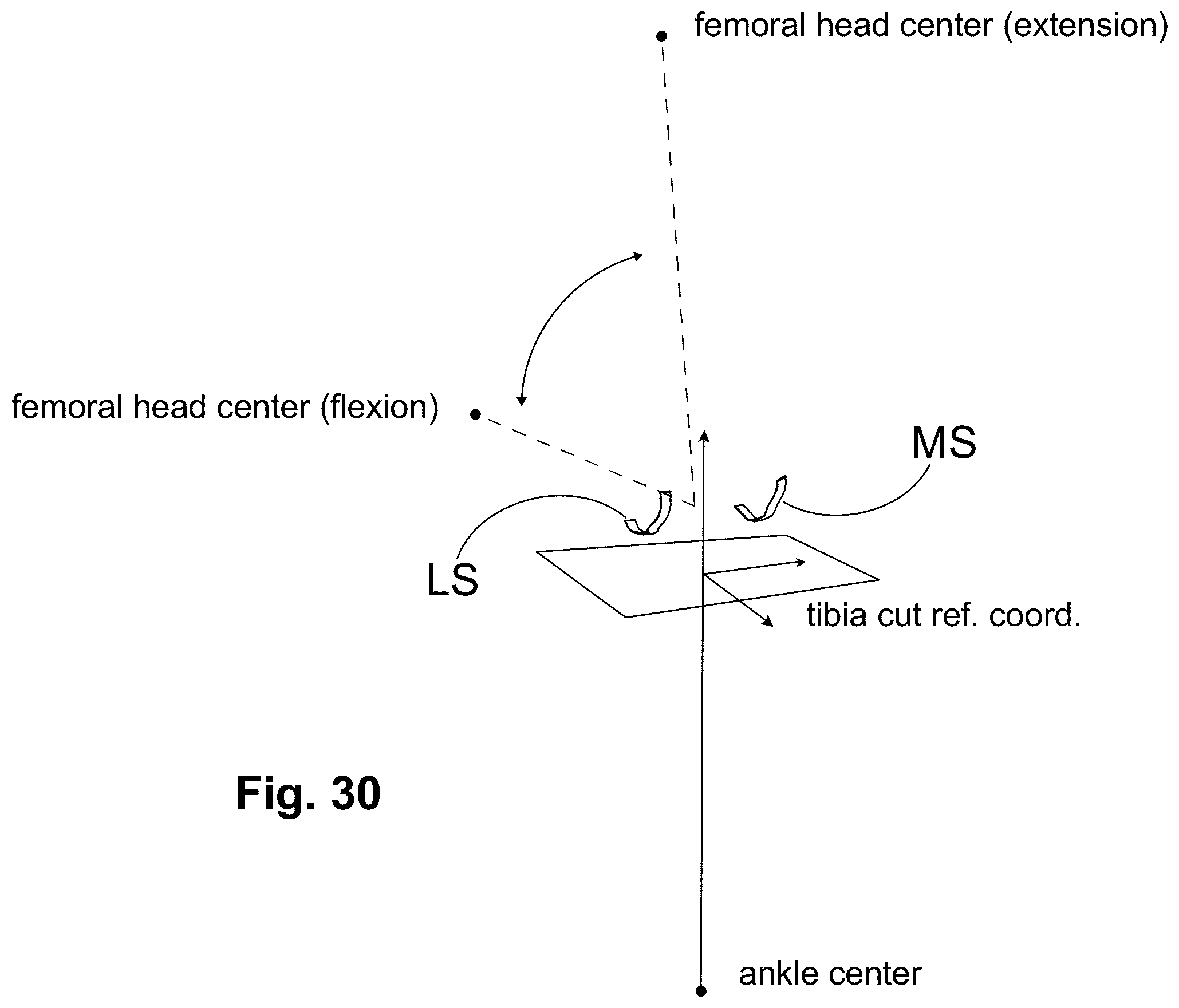 Patent US12303405 Figure 19 – Knee arthroplasty method
