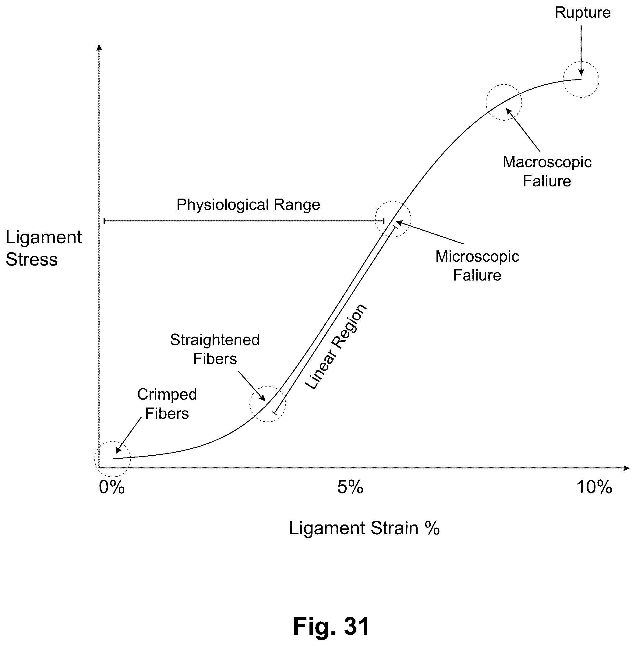 Patent US12303405 Figure 20 – Knee arthroplasty method