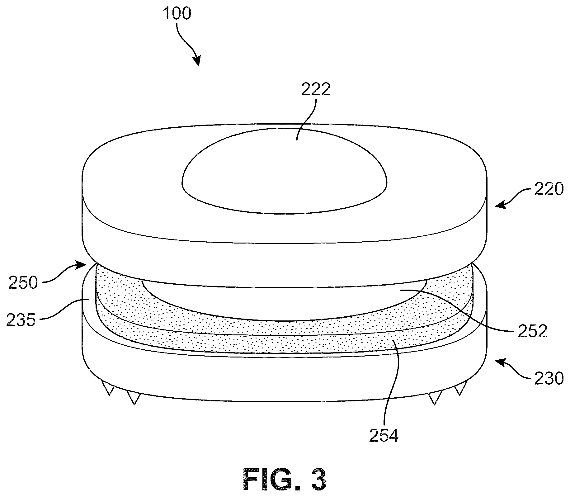 Patent US12303406 Figure 3 – Method of implanting an artificial disc replacement device