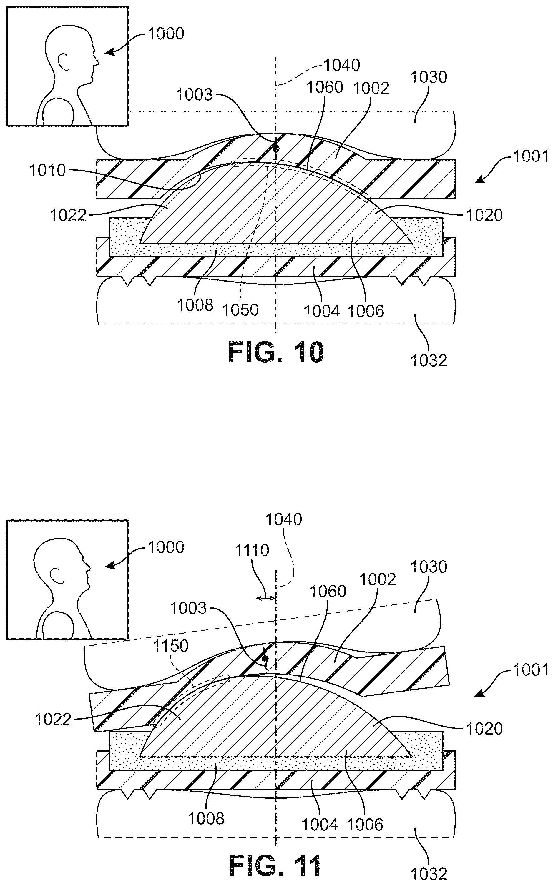 Patent US12303406 Figure 9 – Method of implanting an artificial disc replacement device