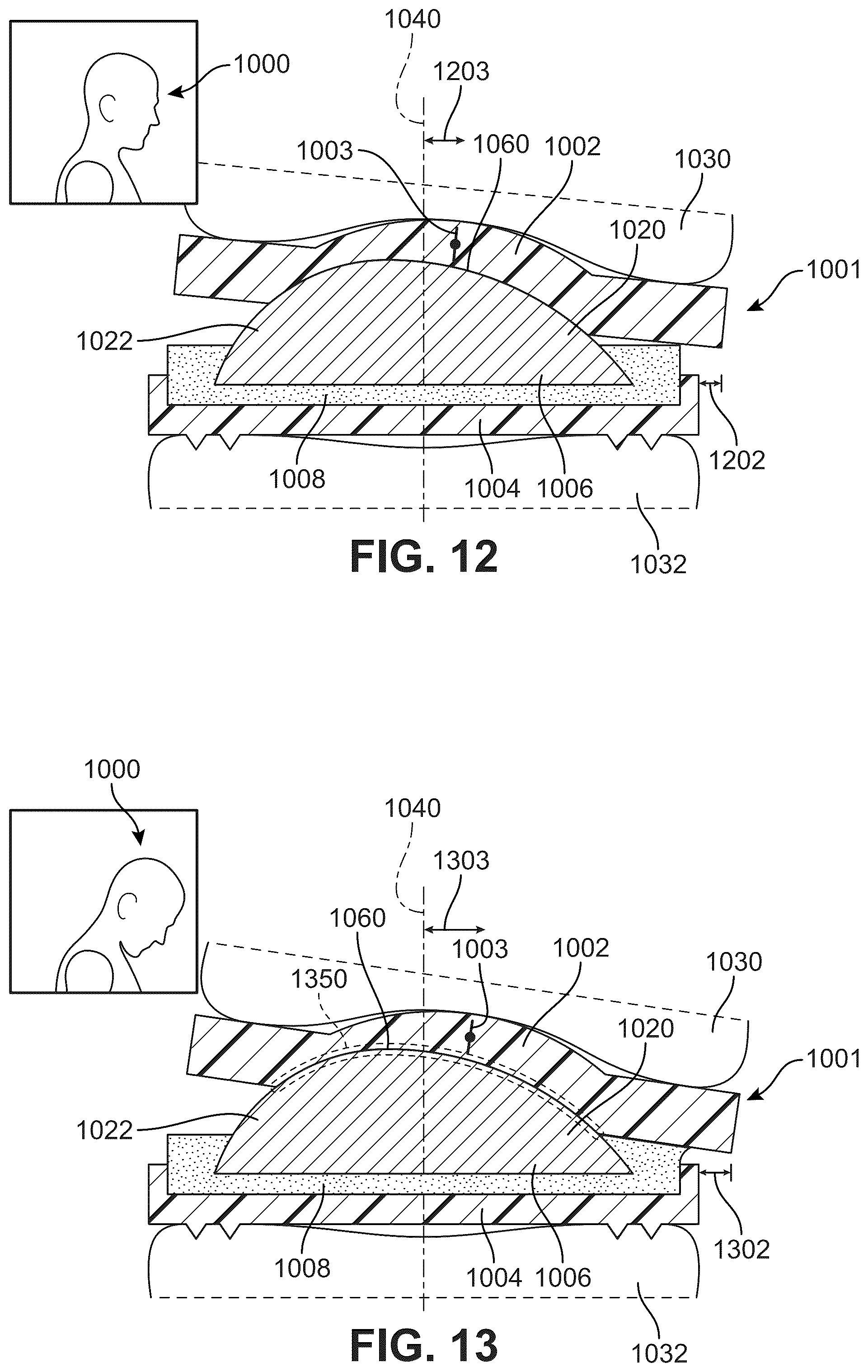 Patent US12303406 Figure 10 – Method of implanting an artificial disc replacement device