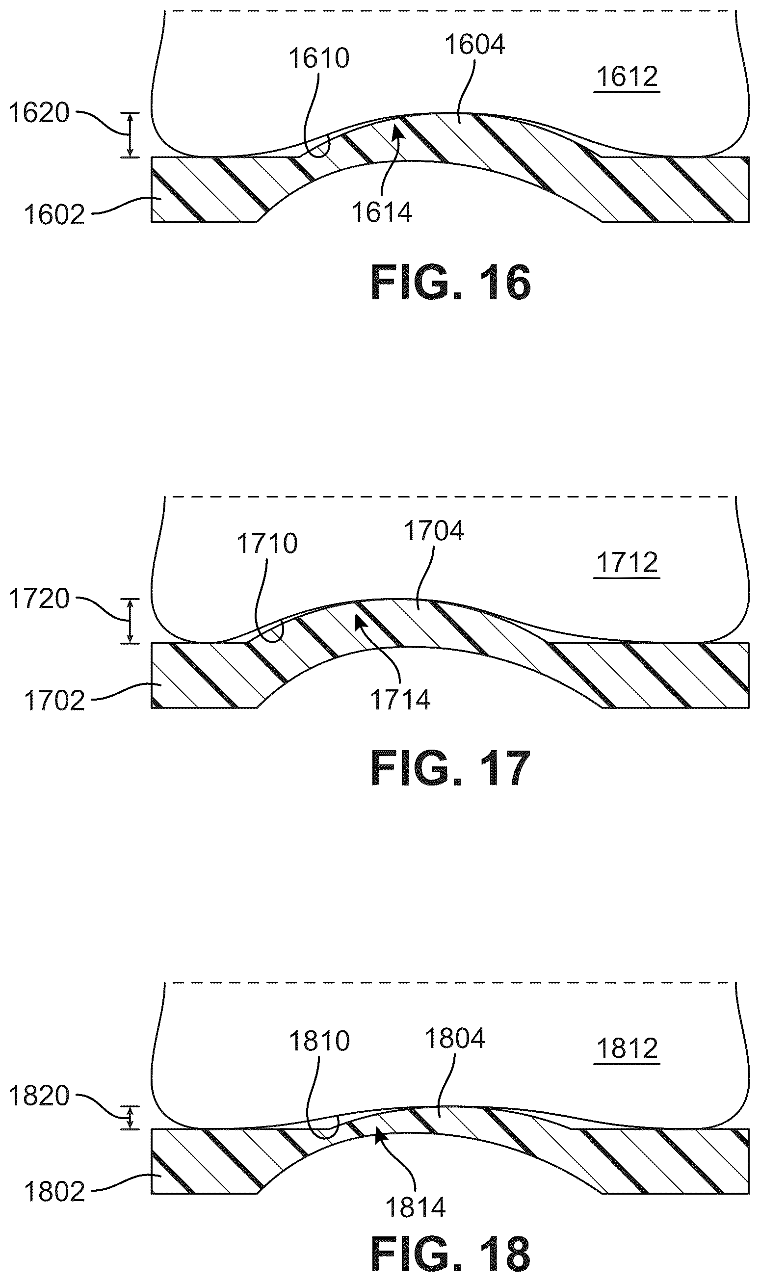 Patent US12303406 Figure 12 – Method of implanting an artificial disc replacement device