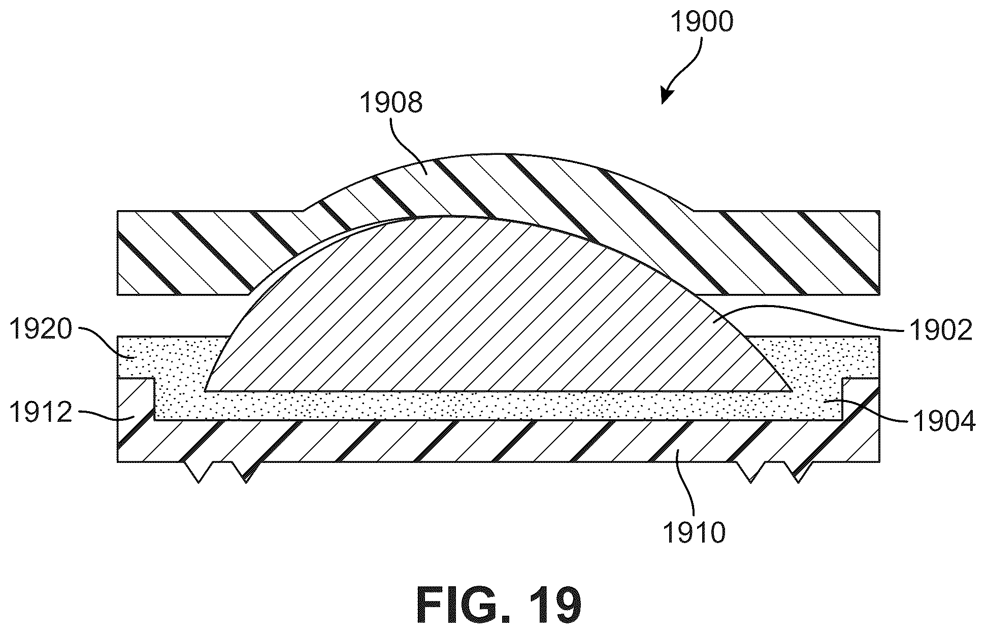 Patent US12303406 Figure 13 – Method of implanting an artificial disc replacement device