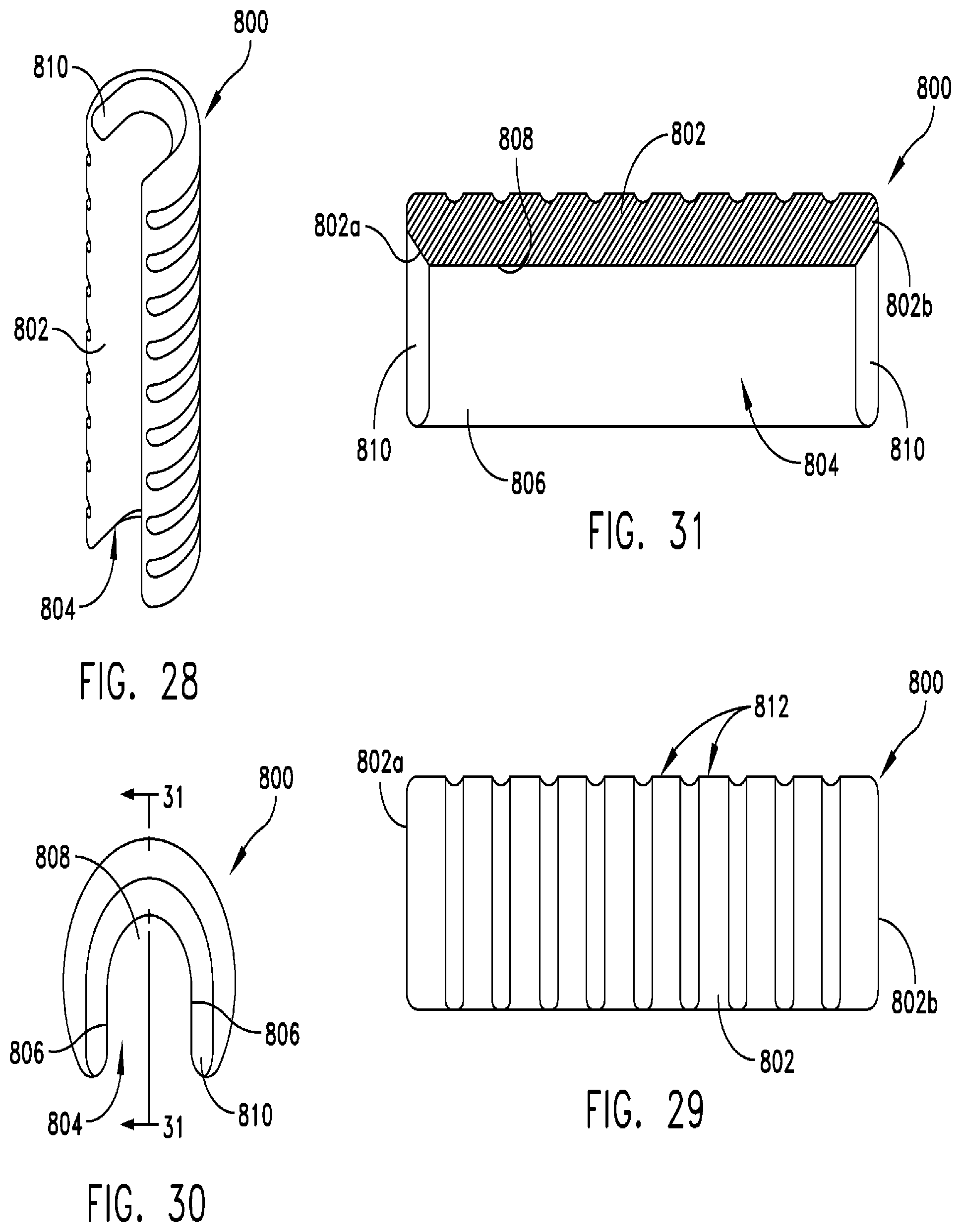Patent US12303407 Figure 10 – Instruments for preparing bone implants