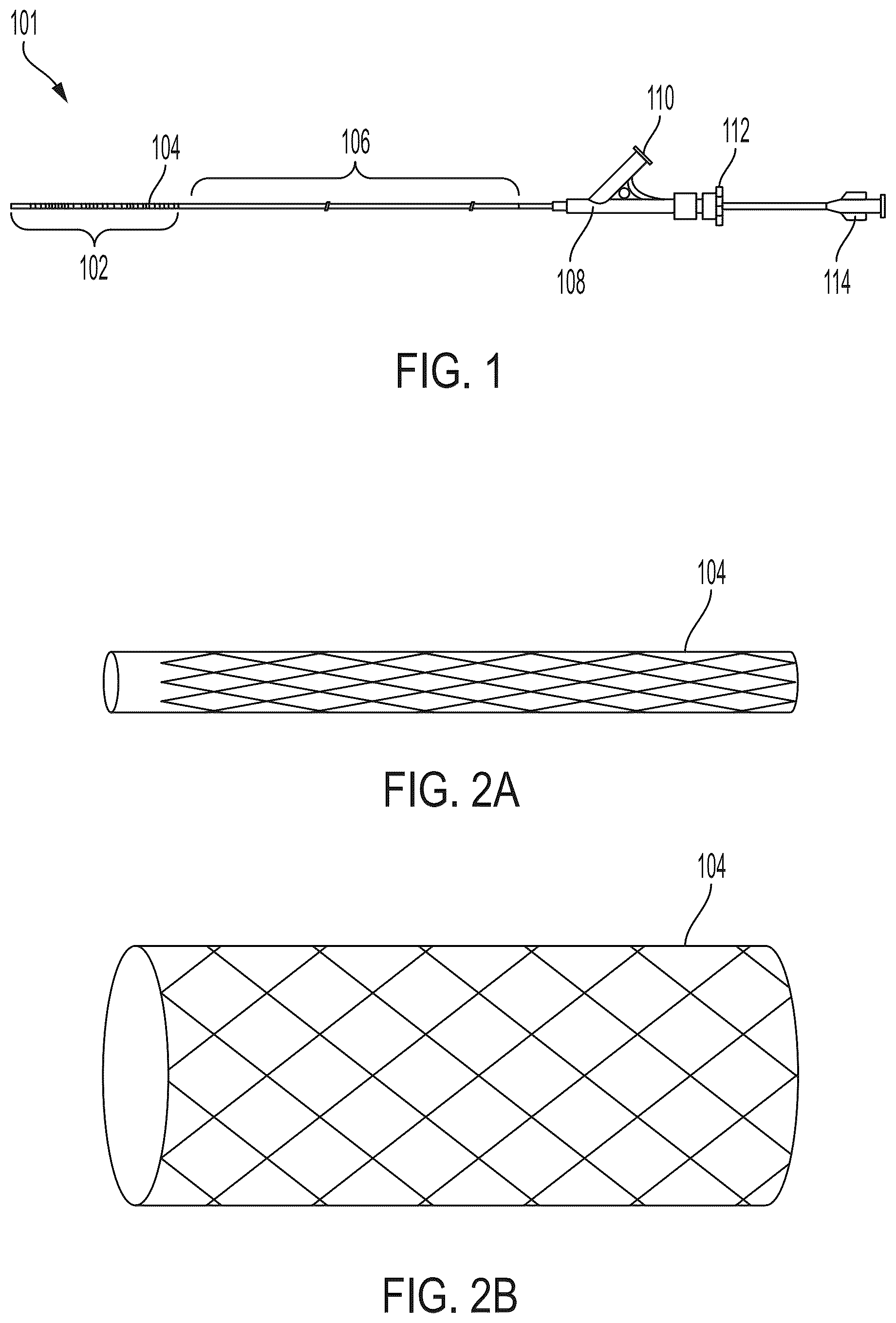 Patent US12303410 Figure 1 – Stent device with stent covering with regions of differing porosity