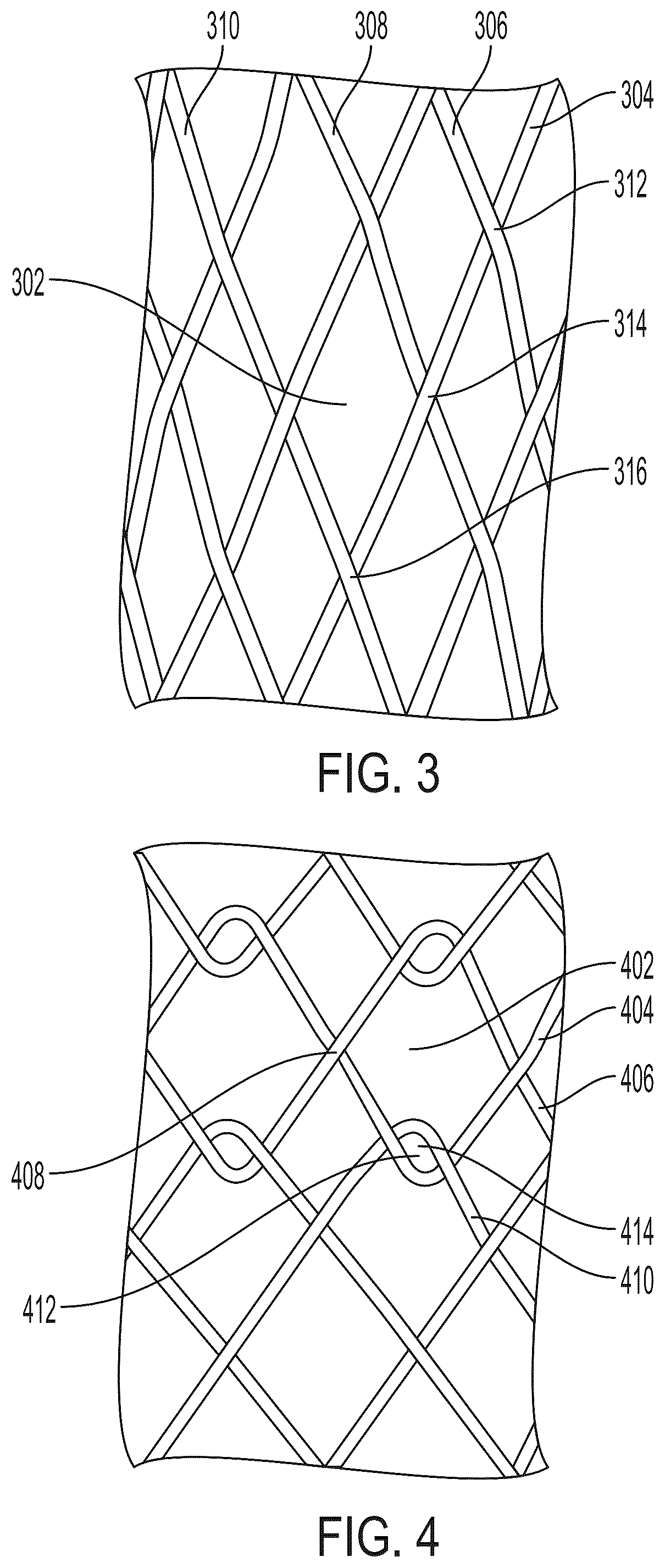 Patent US12303410 Figure 2 – Stent device with stent covering with regions of differing porosity