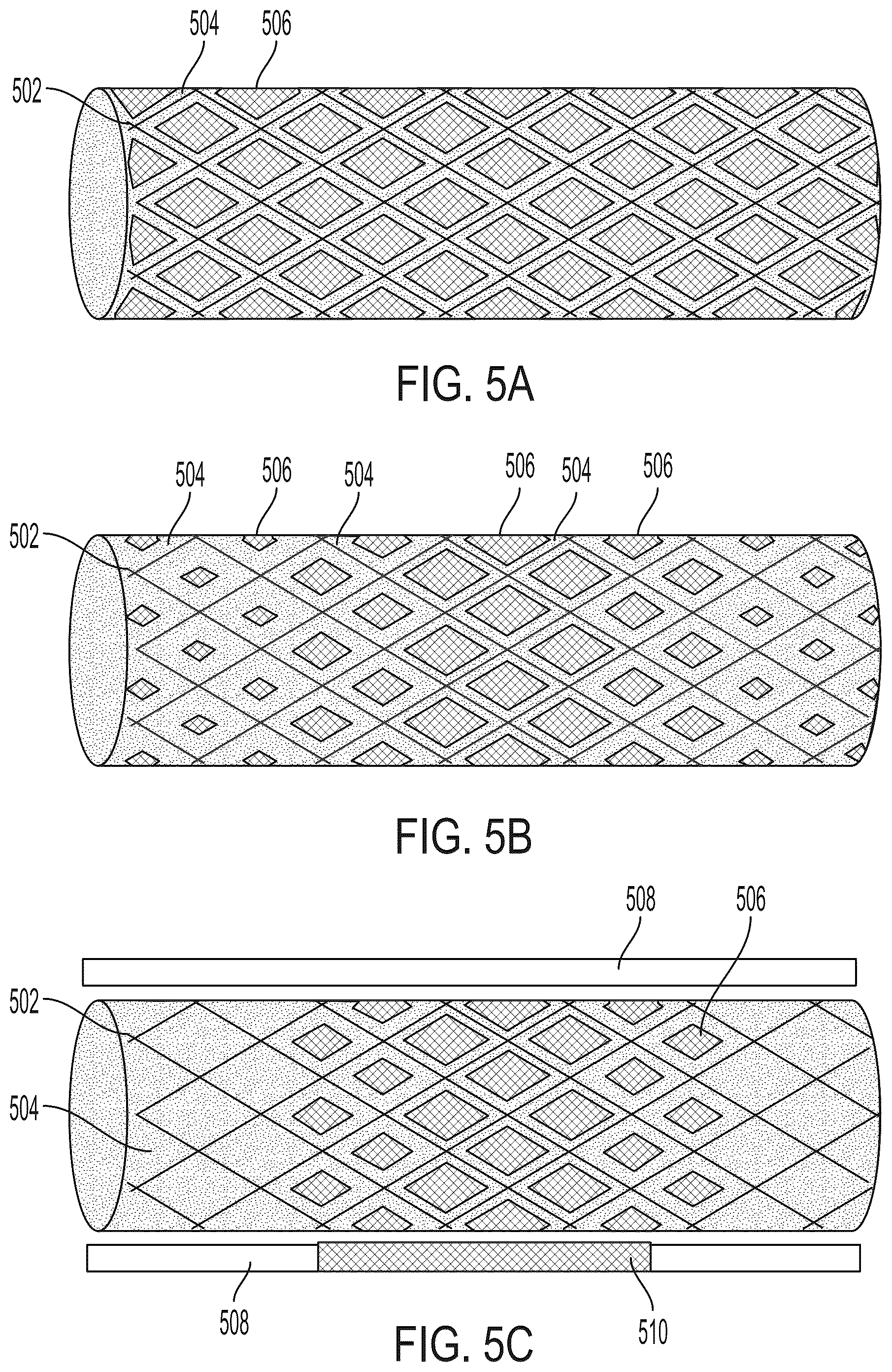 Patent US12303410 Figure 3 – Stent device with stent covering with regions of differing porosity