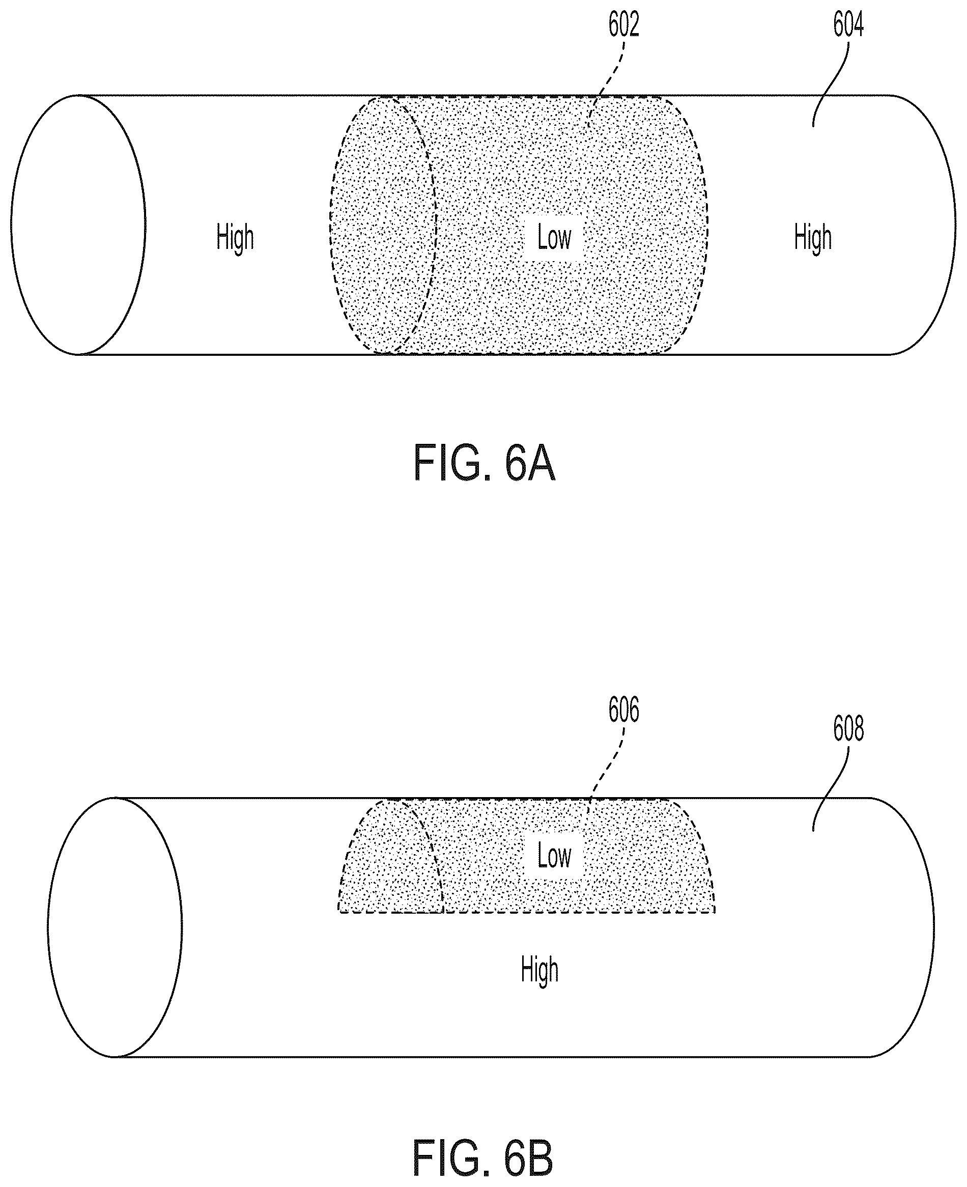 Patent US12303410 Figure 4 – Stent device with stent covering with regions of differing porosity