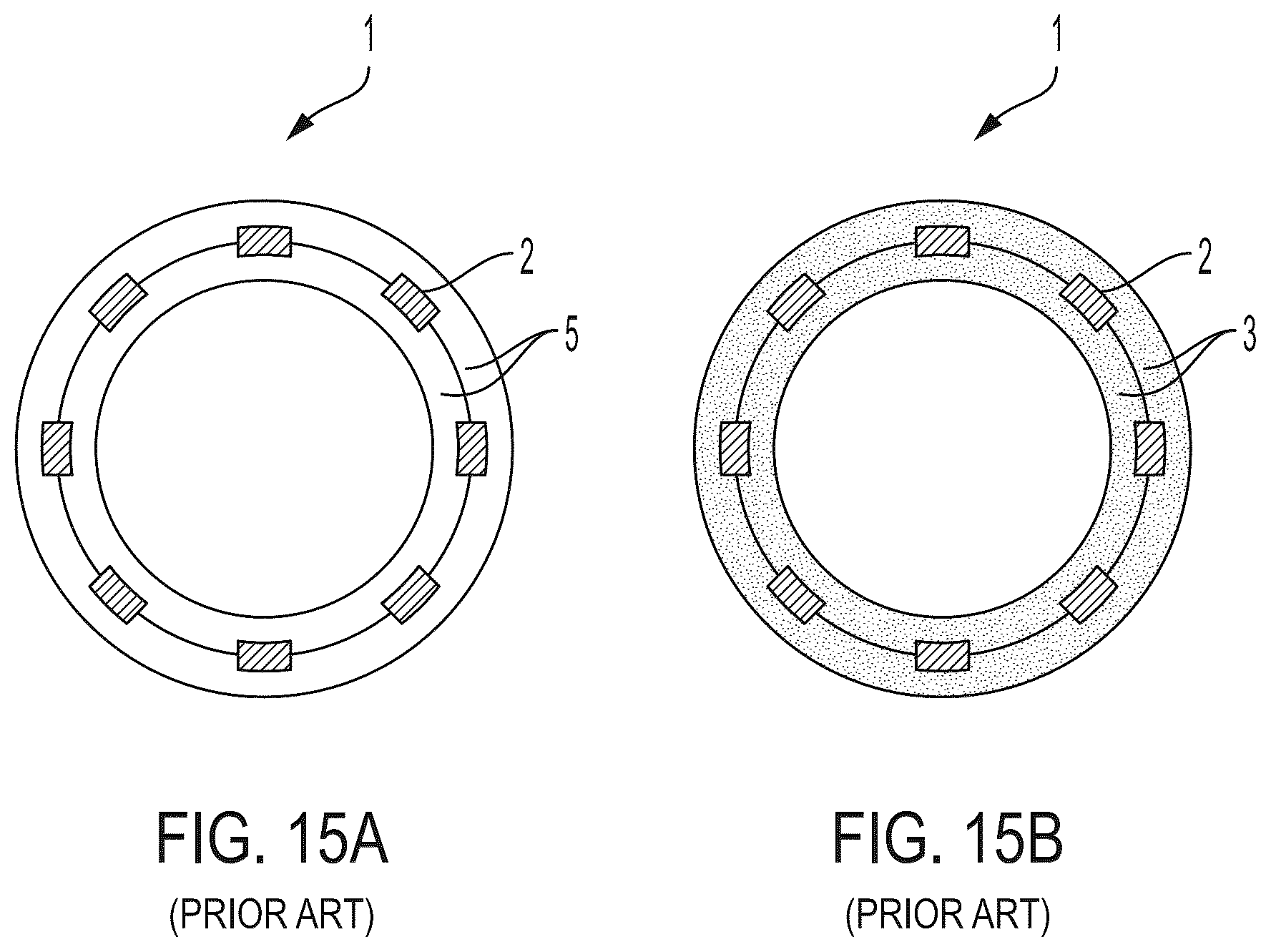 Patent US12303410 Figure 11 – Stent device with stent covering with regions of differing porosity