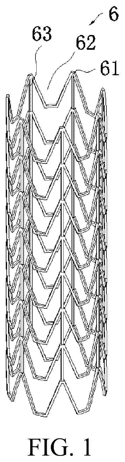 Patent US12303411 Figure 1 – Left ventricular outflow tract stent and delivery system