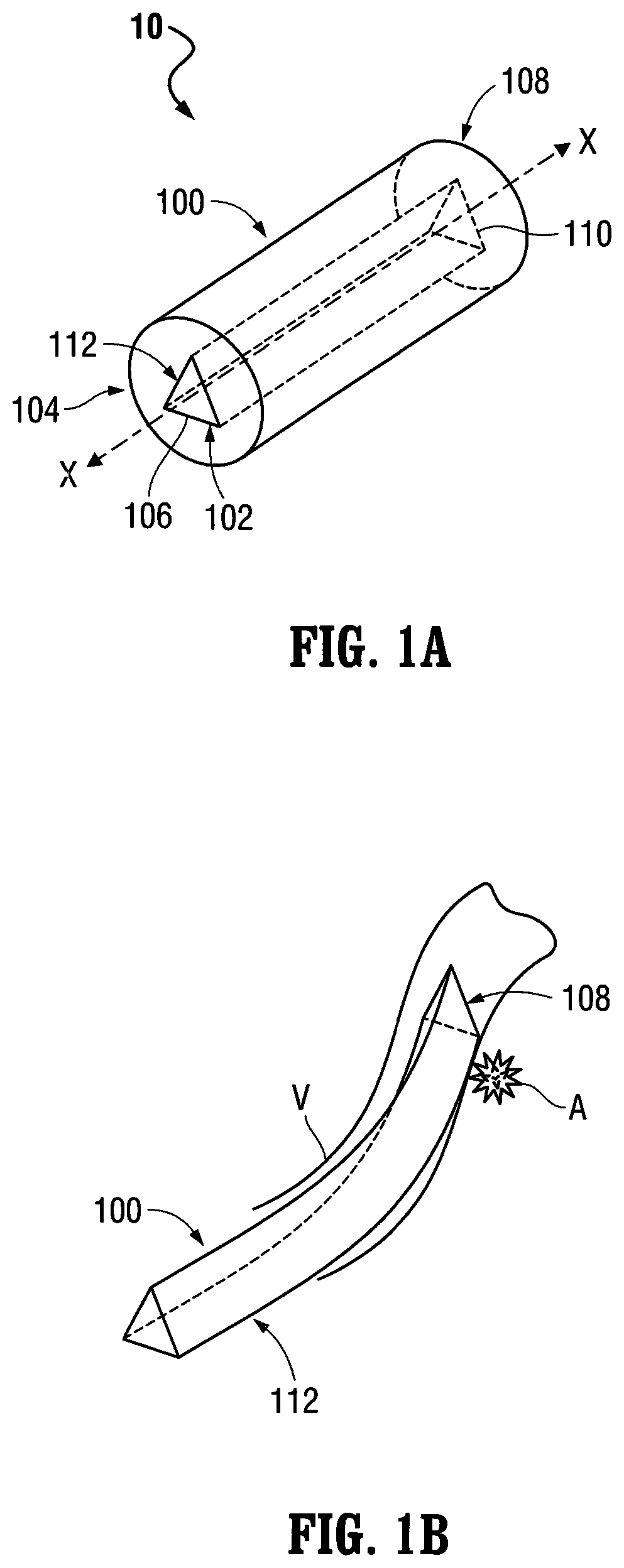 Patent US12303412 Figure 1 – Orientable implantable device and method