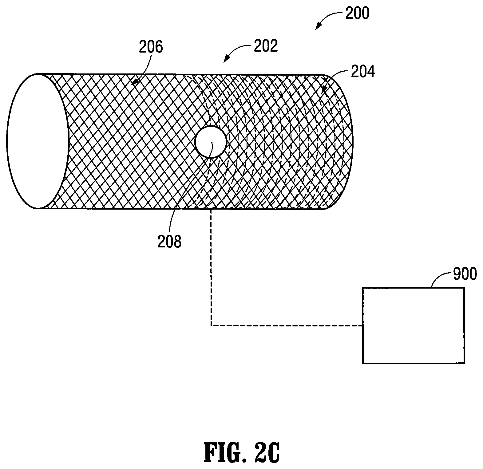 Patent US12303412 Figure 4 – Orientable implantable device and method