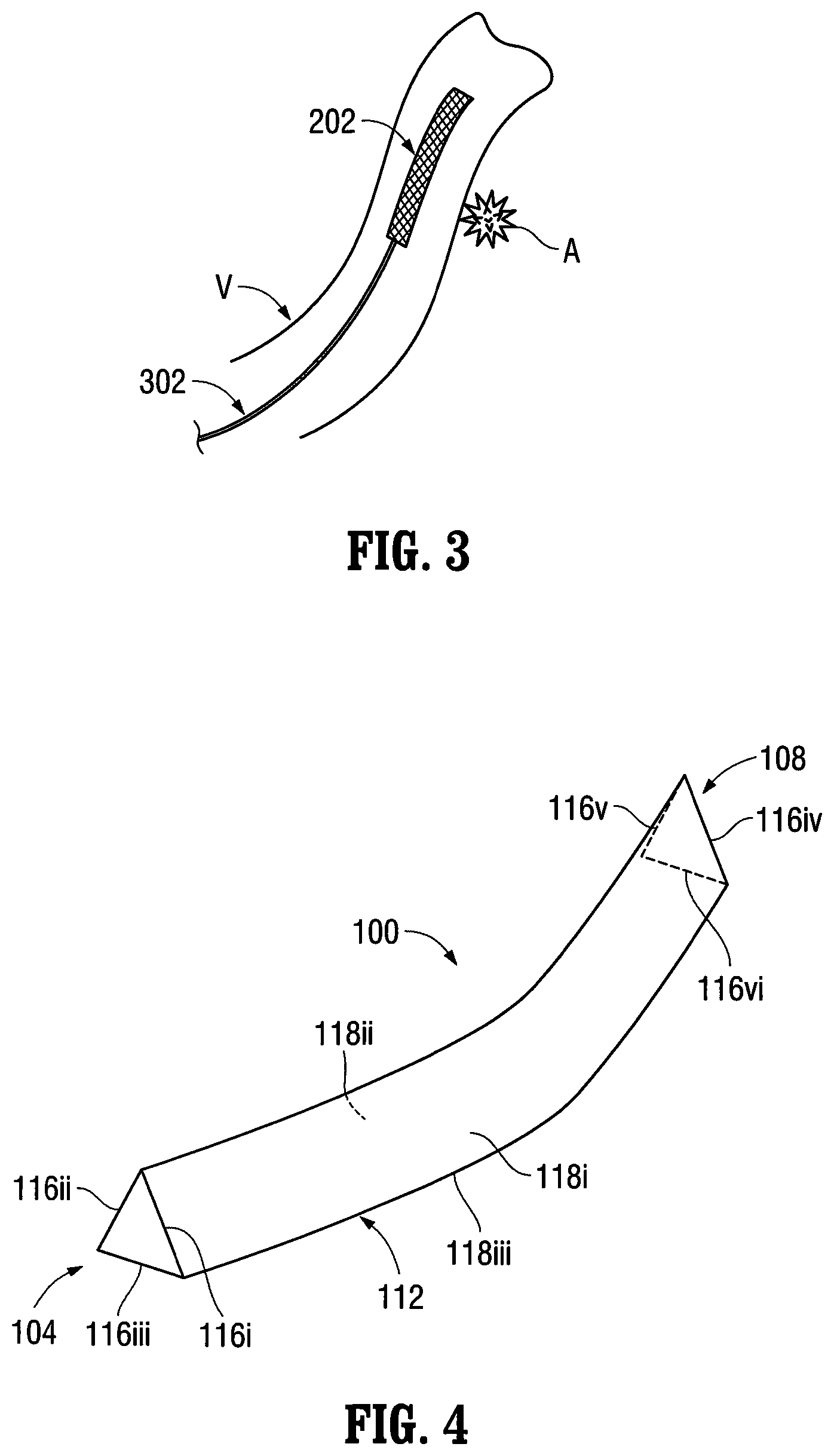 Patent US12303413 Figure 5 – Orientable implantable device and method