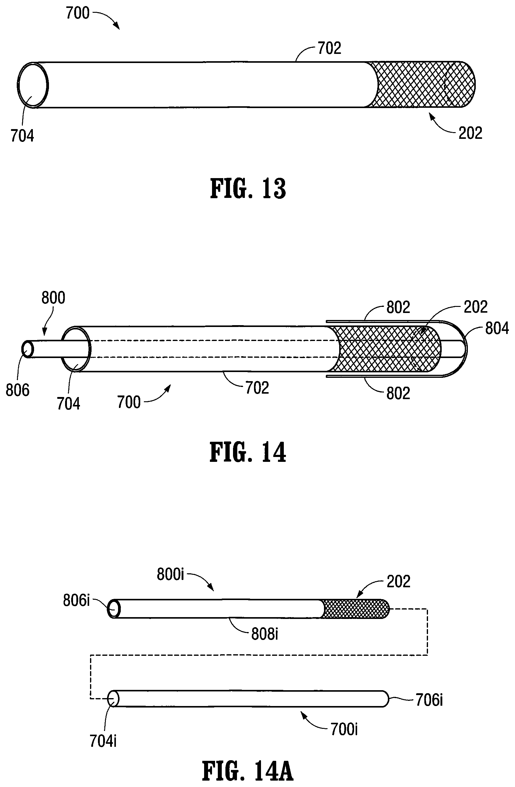 Patent US12303413 Figure 9 – Orientable implantable device and method