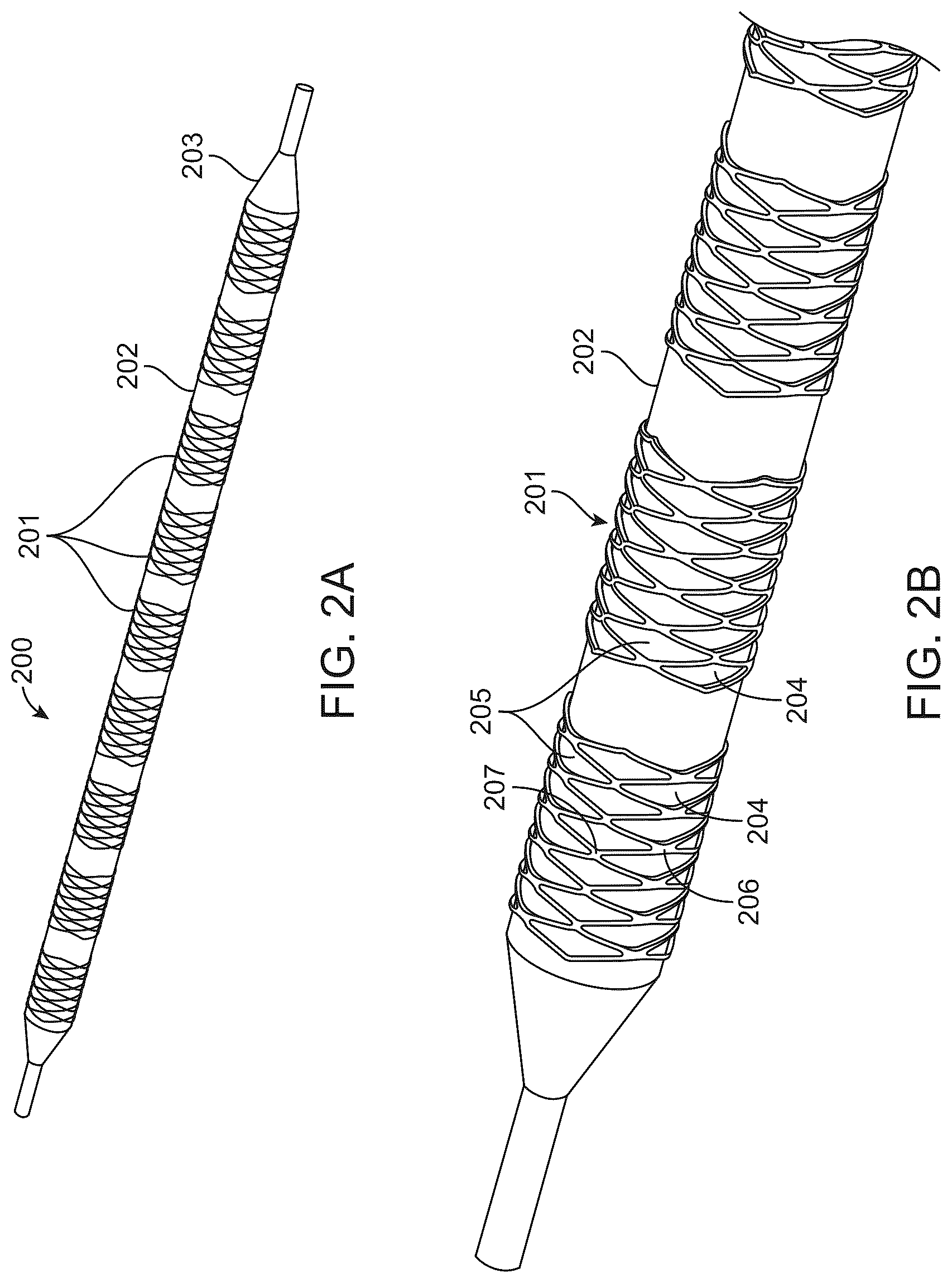 Patent US12303414 Figure 2 – Absorbable intravascular devices that shorten upon expansion creating space for vascular movement