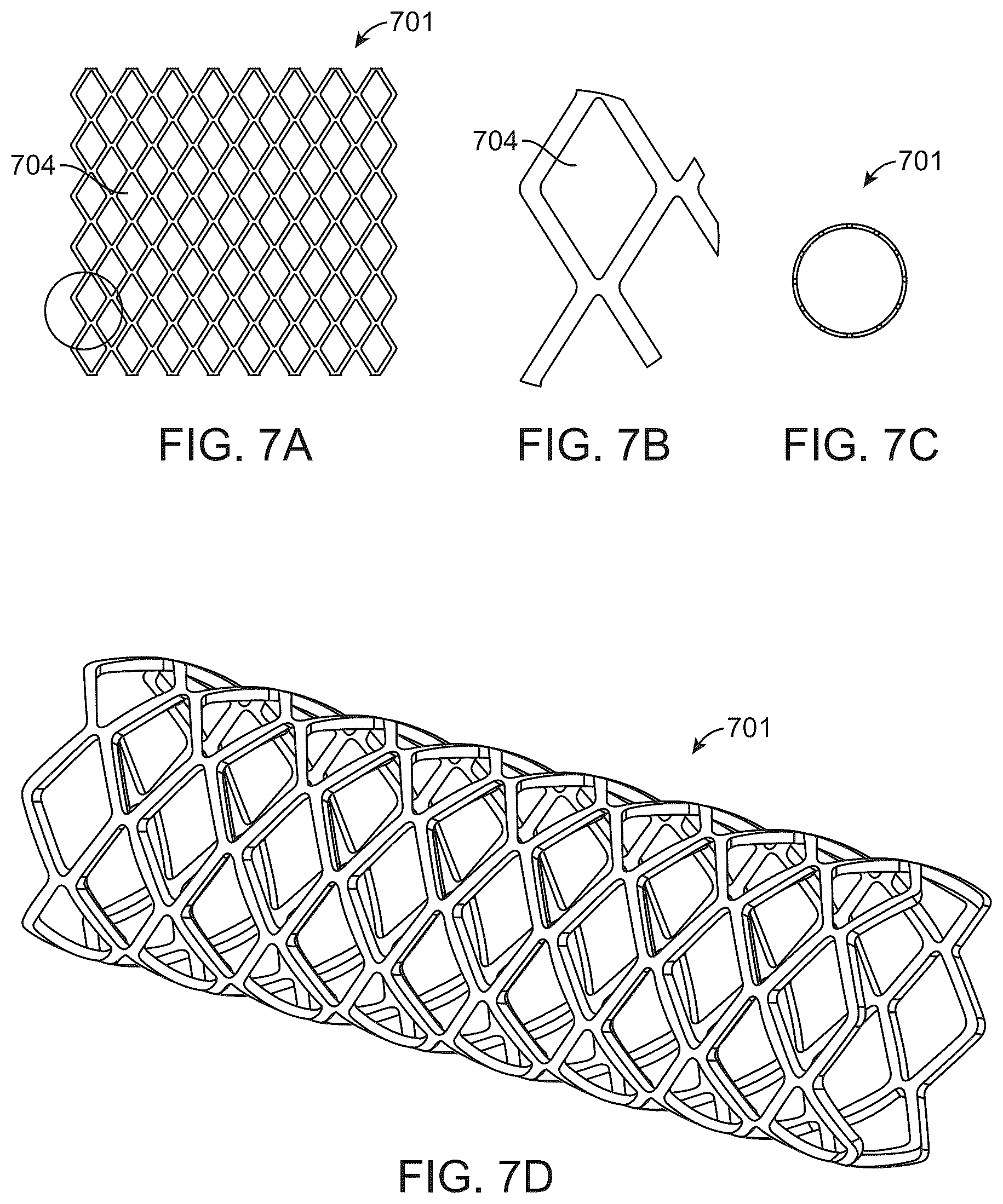 Patent US12303414 Figure 7 – Absorbable intravascular devices that shorten upon expansion creating space for vascular movement