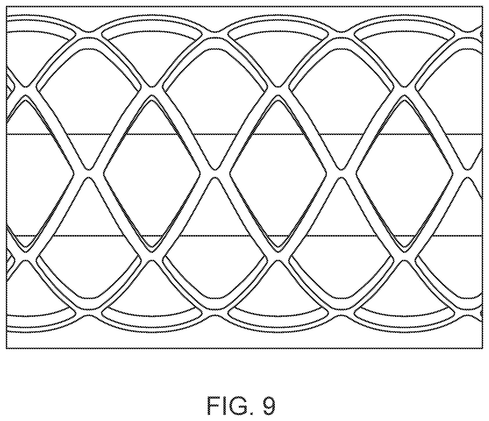 Patent US12303414 Figure 9 – Absorbable intravascular devices that shorten upon expansion creating space for vascular movement