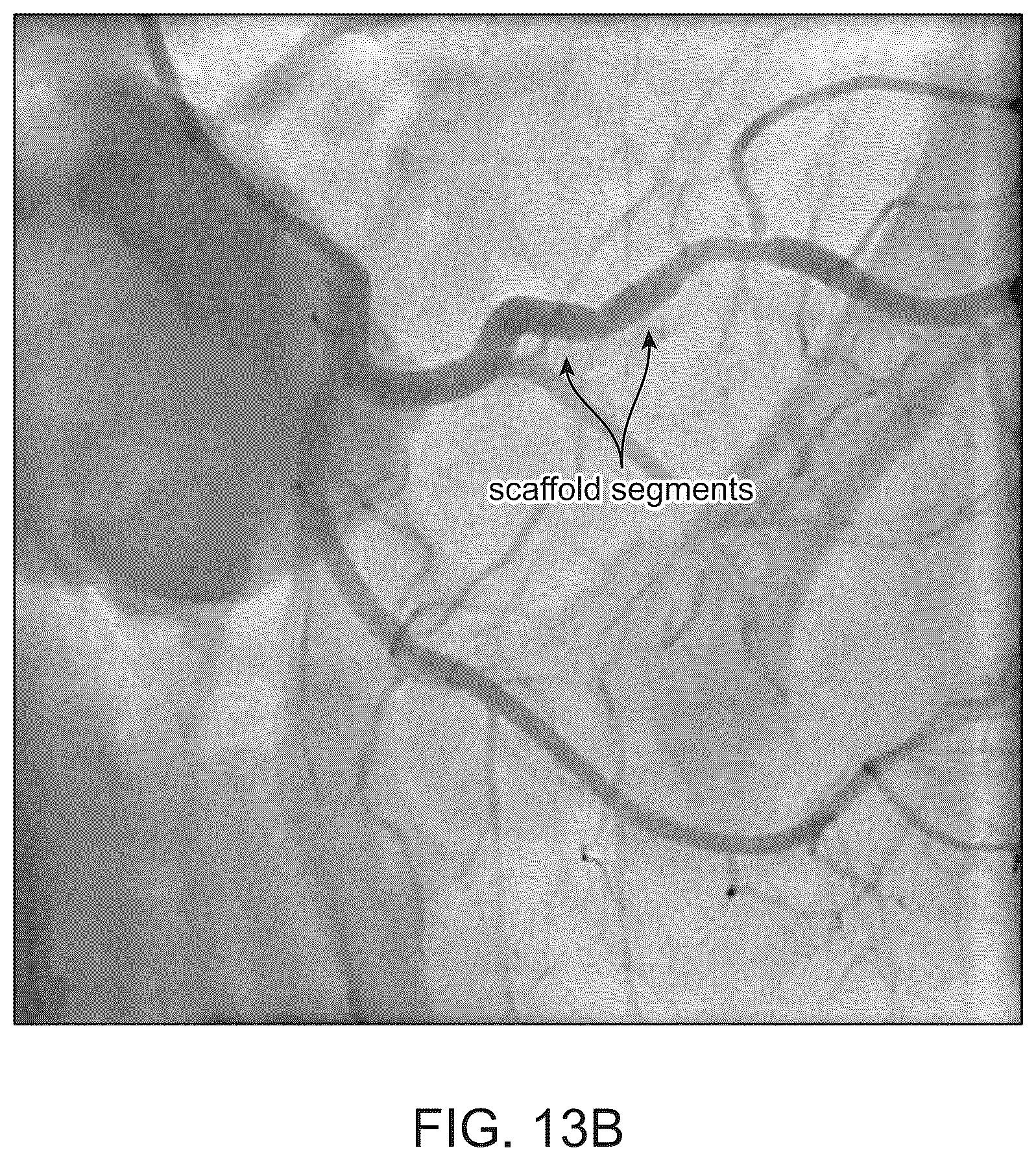 Patent US12303414 Figure 15 – Absorbable intravascular devices that shorten upon expansion creating space for vascular movement