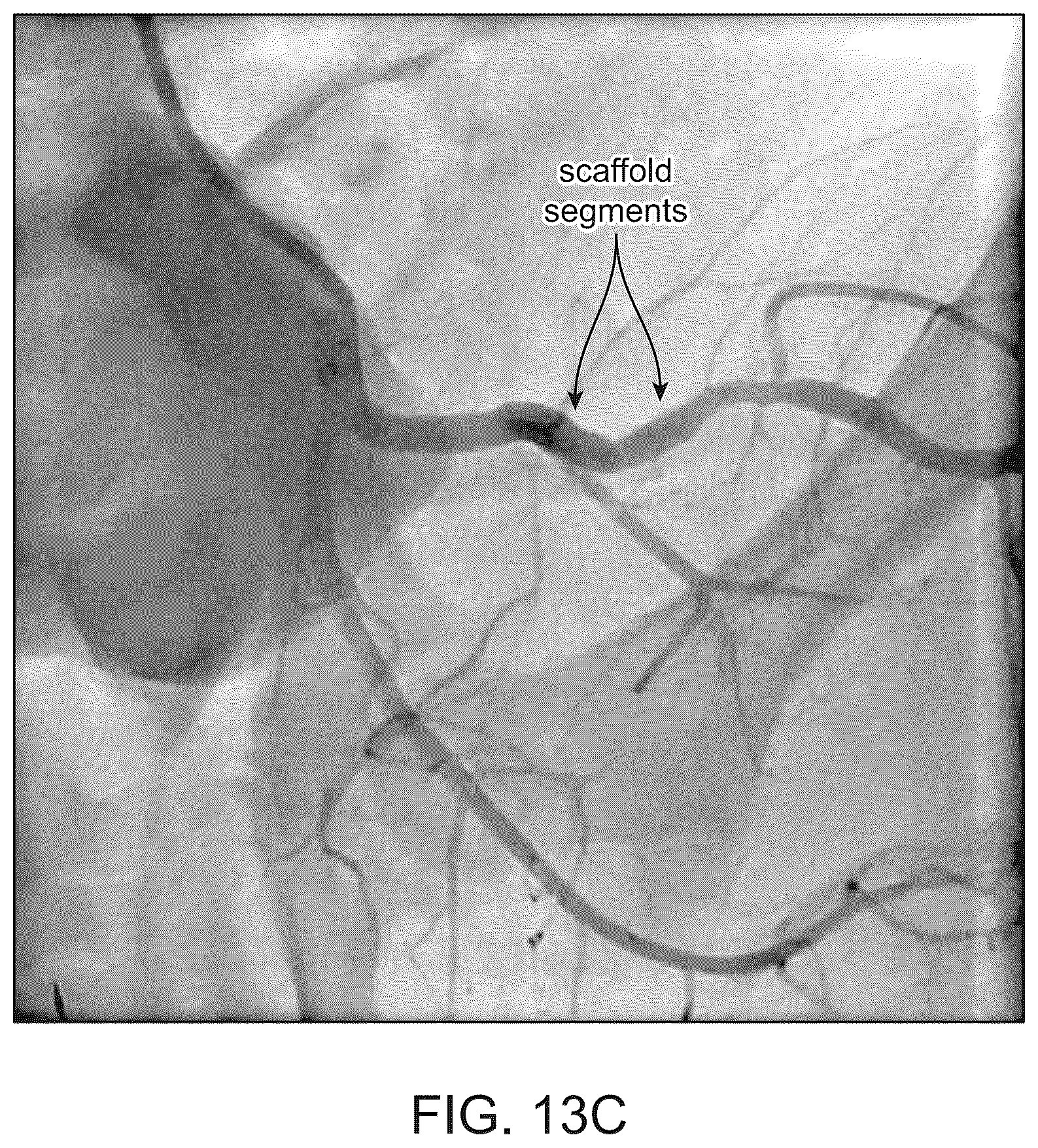 Patent US12303414 Figure 16 – Absorbable intravascular devices that shorten upon expansion creating space for vascular movement