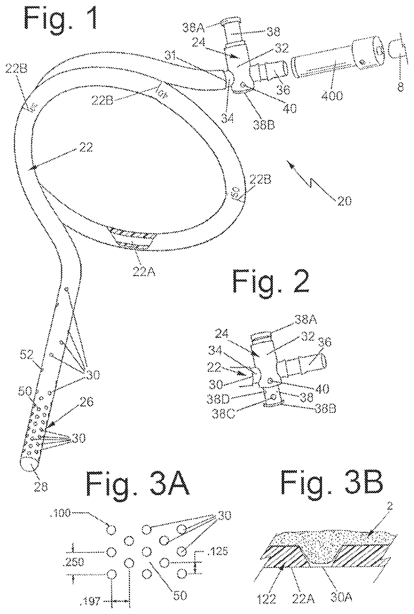 Patent US12303415 Figure 1 – Systems and methods for performing bariatric surgery