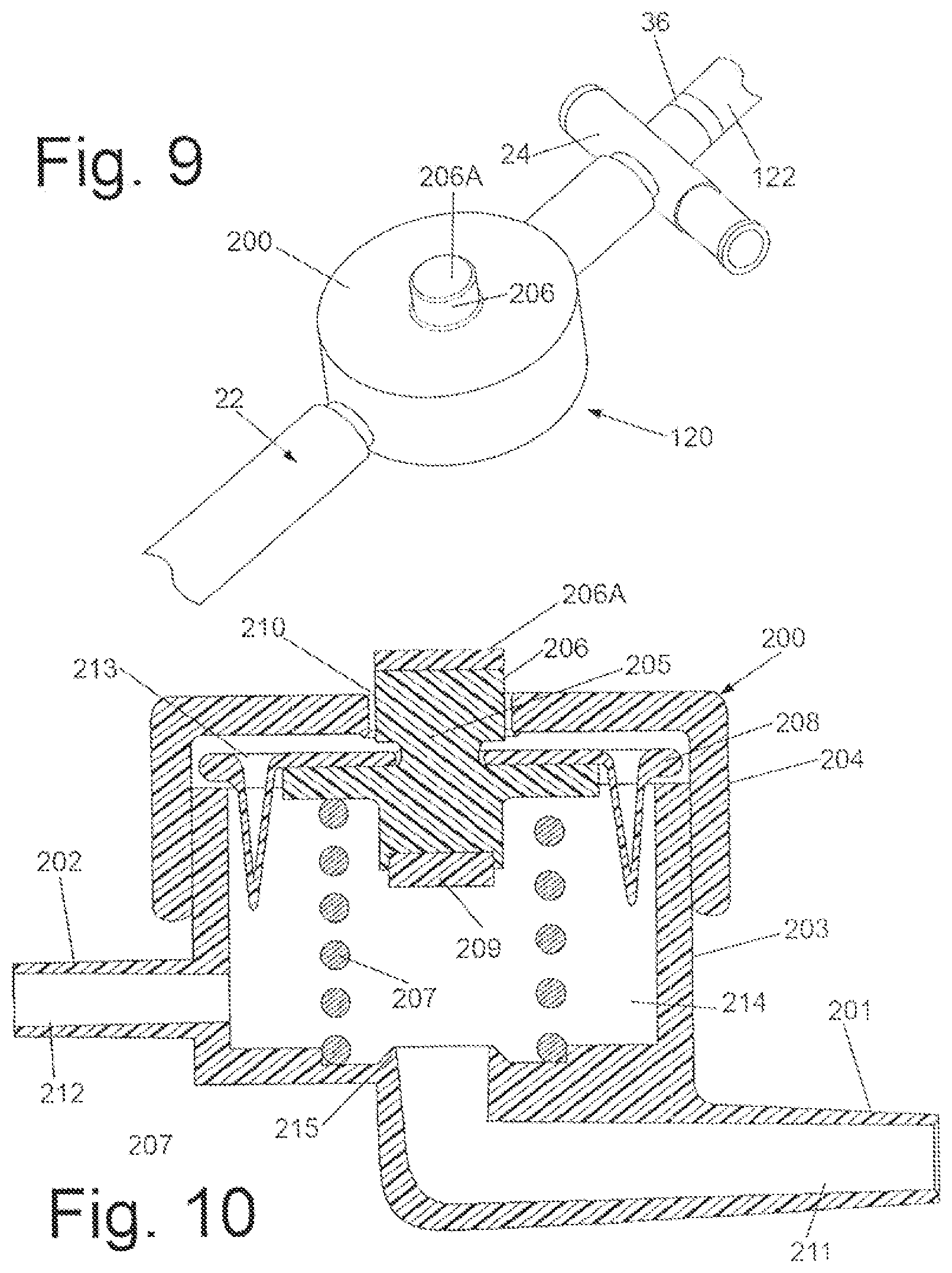 Patent US12303415 Figure 3 – Systems and methods for performing bariatric surgery