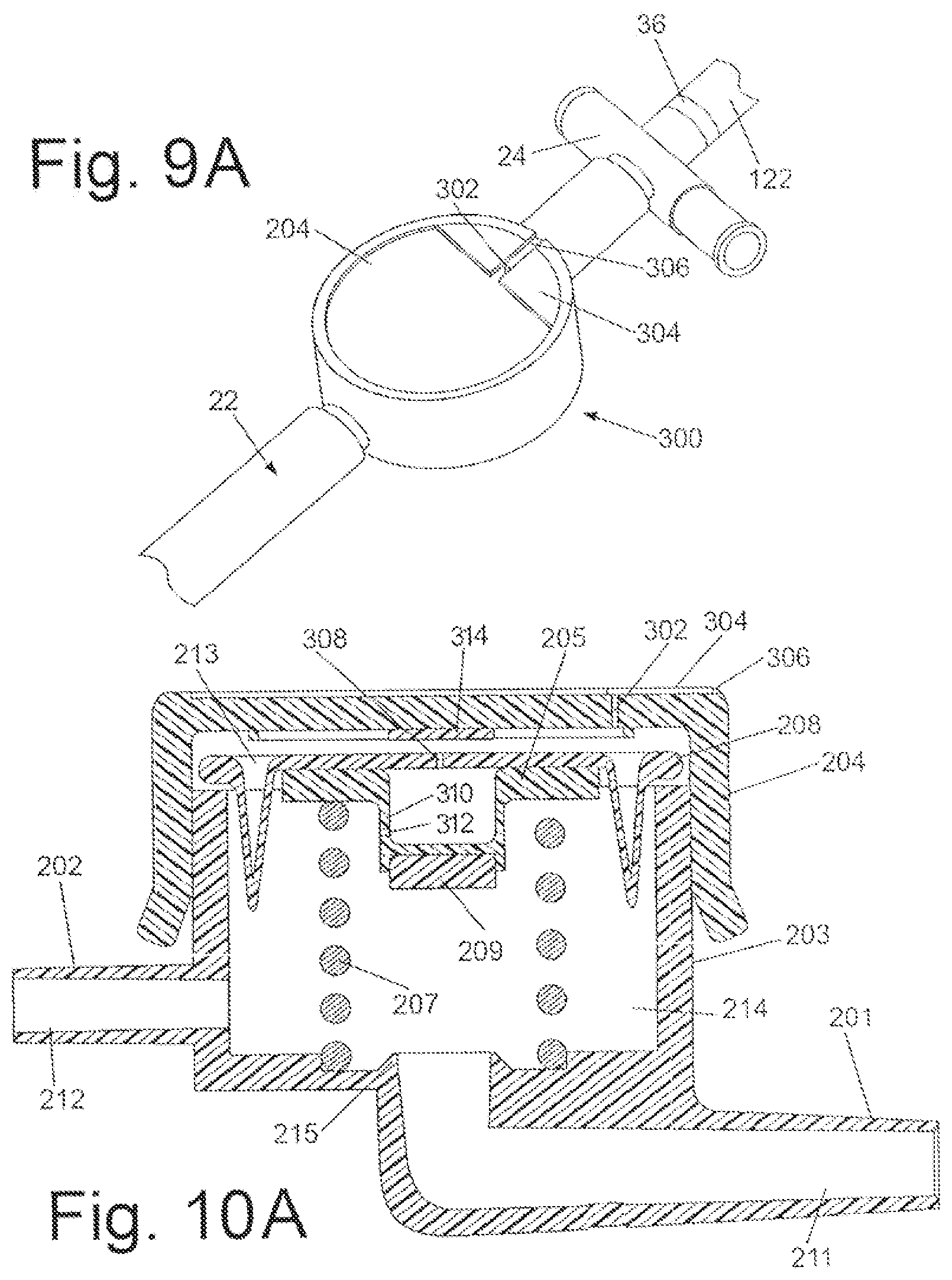 Patent US12303415 Figure 4 – Systems and methods for performing bariatric surgery