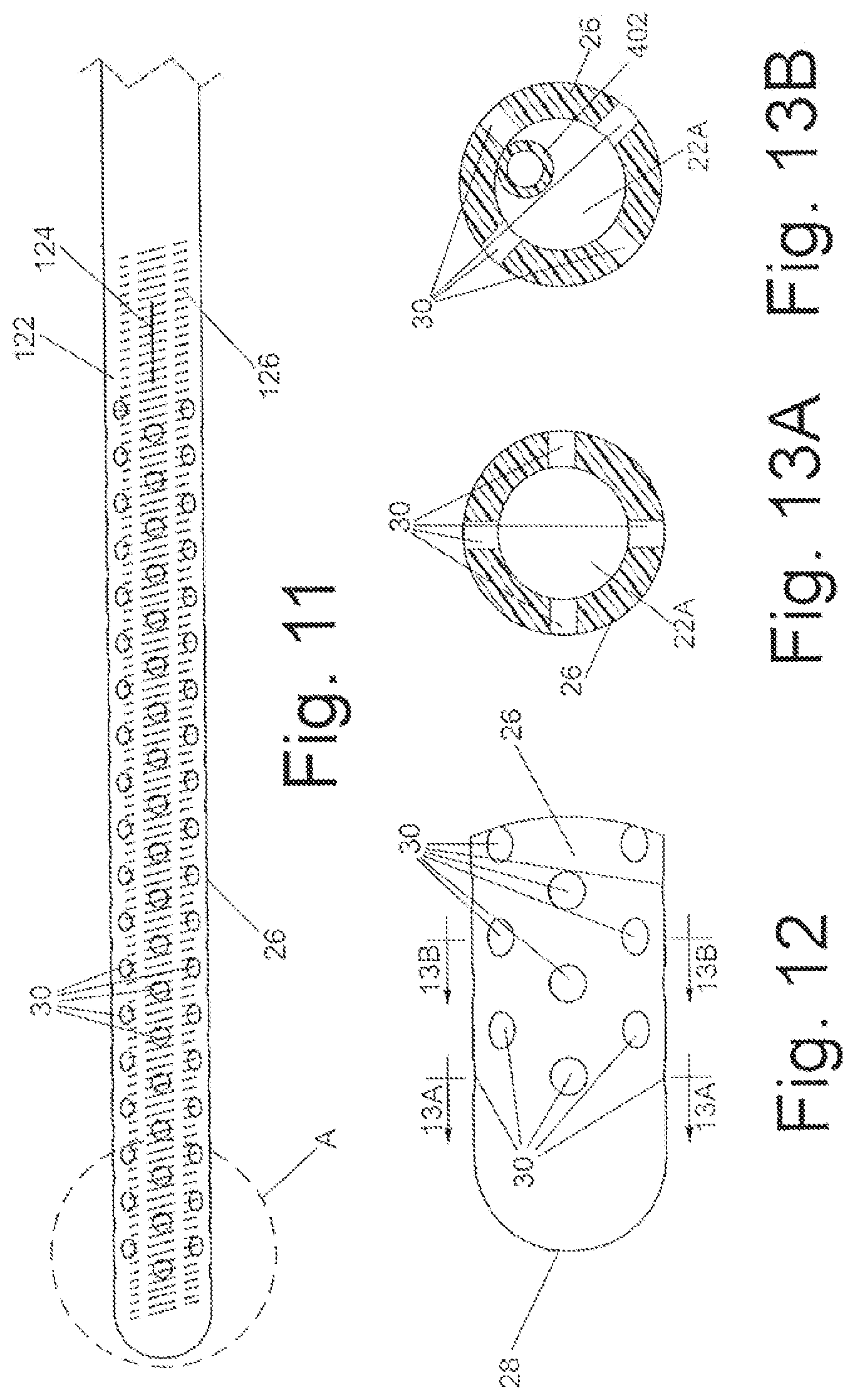 Patent US12303415 Figure 5 – Systems and methods for performing bariatric surgery
