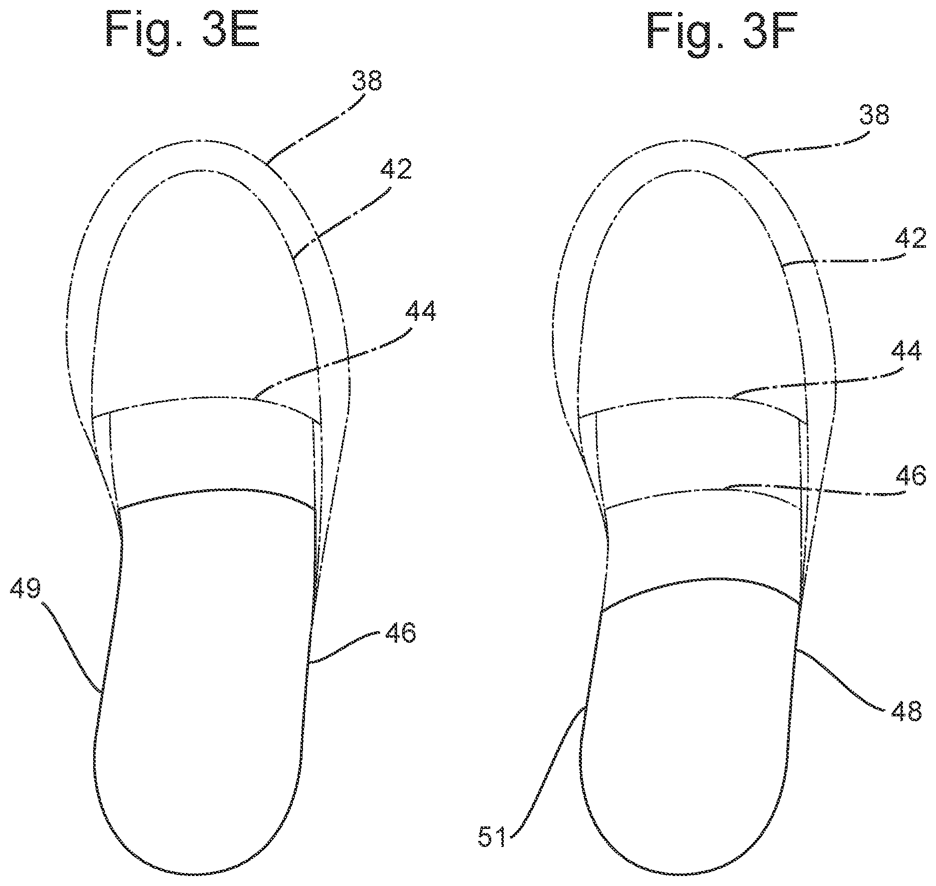 Patent US12303419 Figure 5 – Orthosis